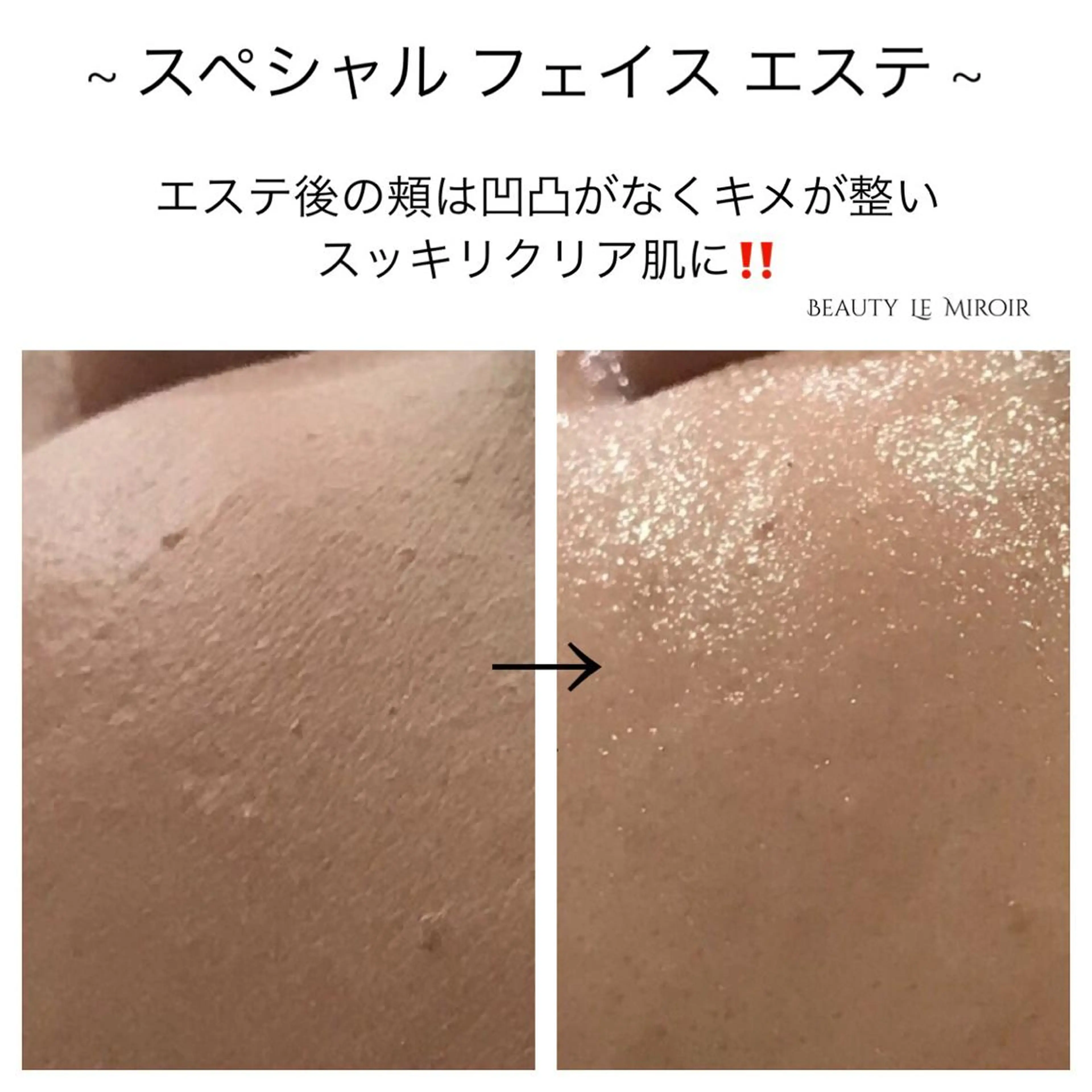 ビューティー ミロワールのエステ・リラクイメージ