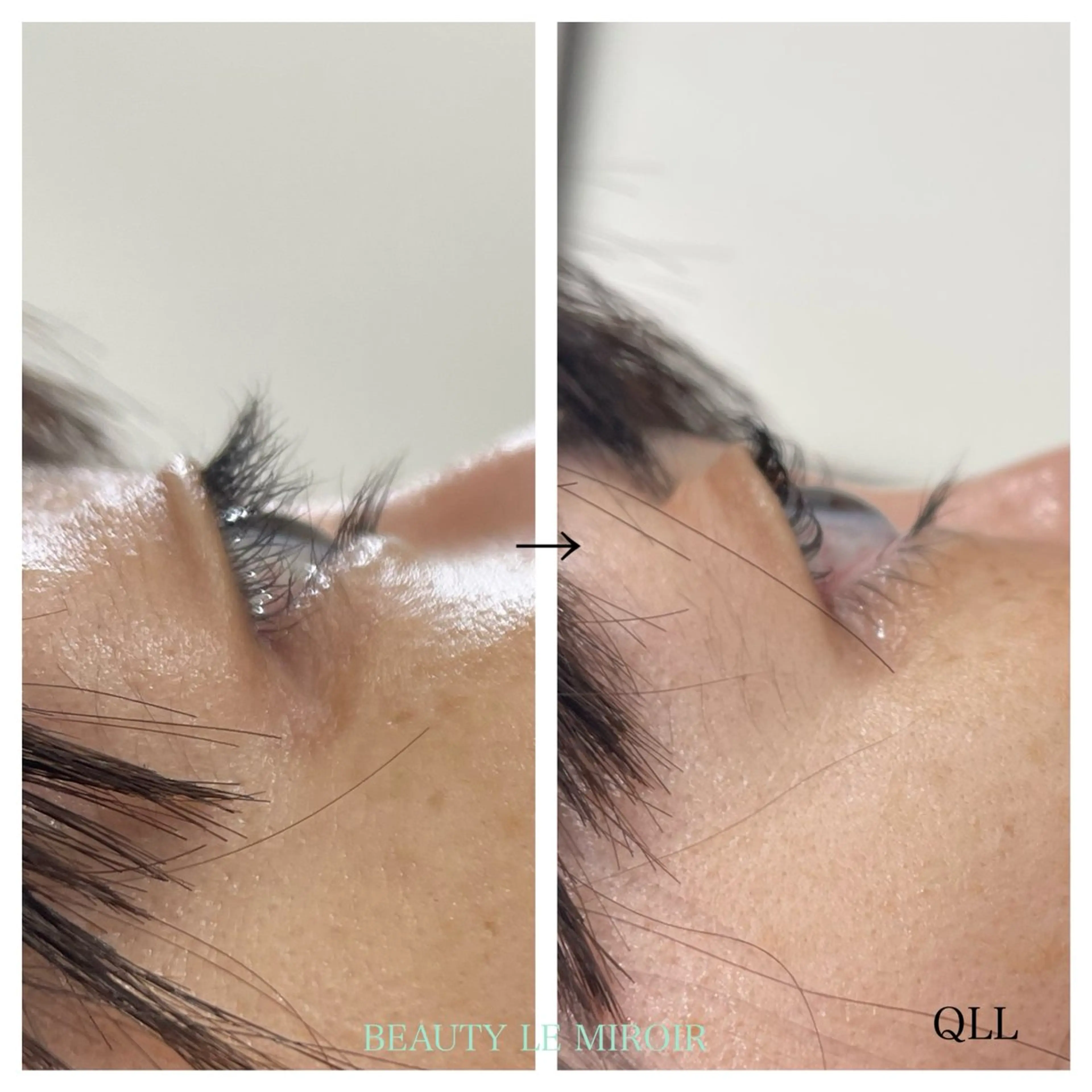 マツエク・マツパ ビューティー ミロワールのエステ・リラクイメージ