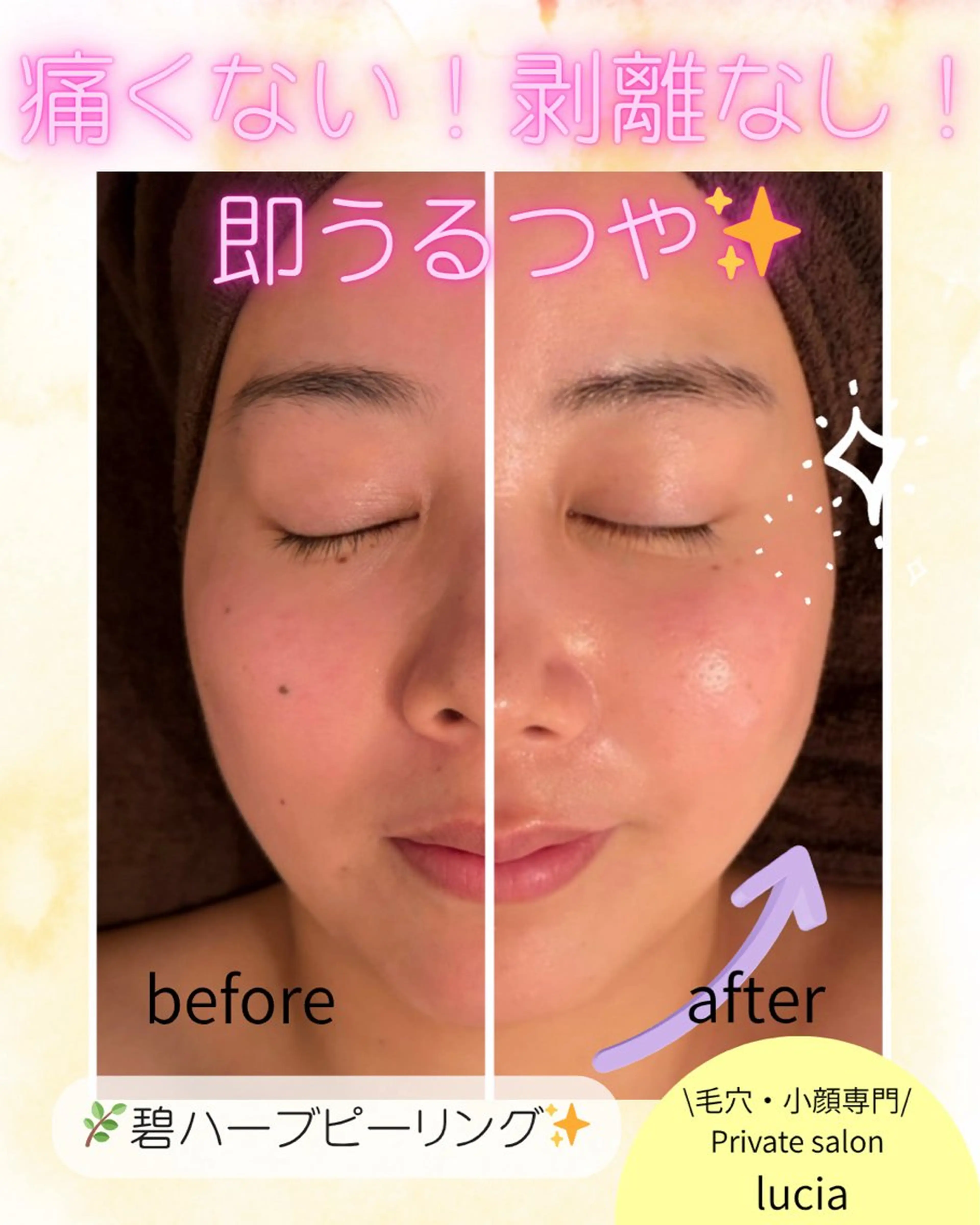 エステ ビューティーサロンルシア所属・lucia  豊明 肌管理のエステ・リラクイメージ