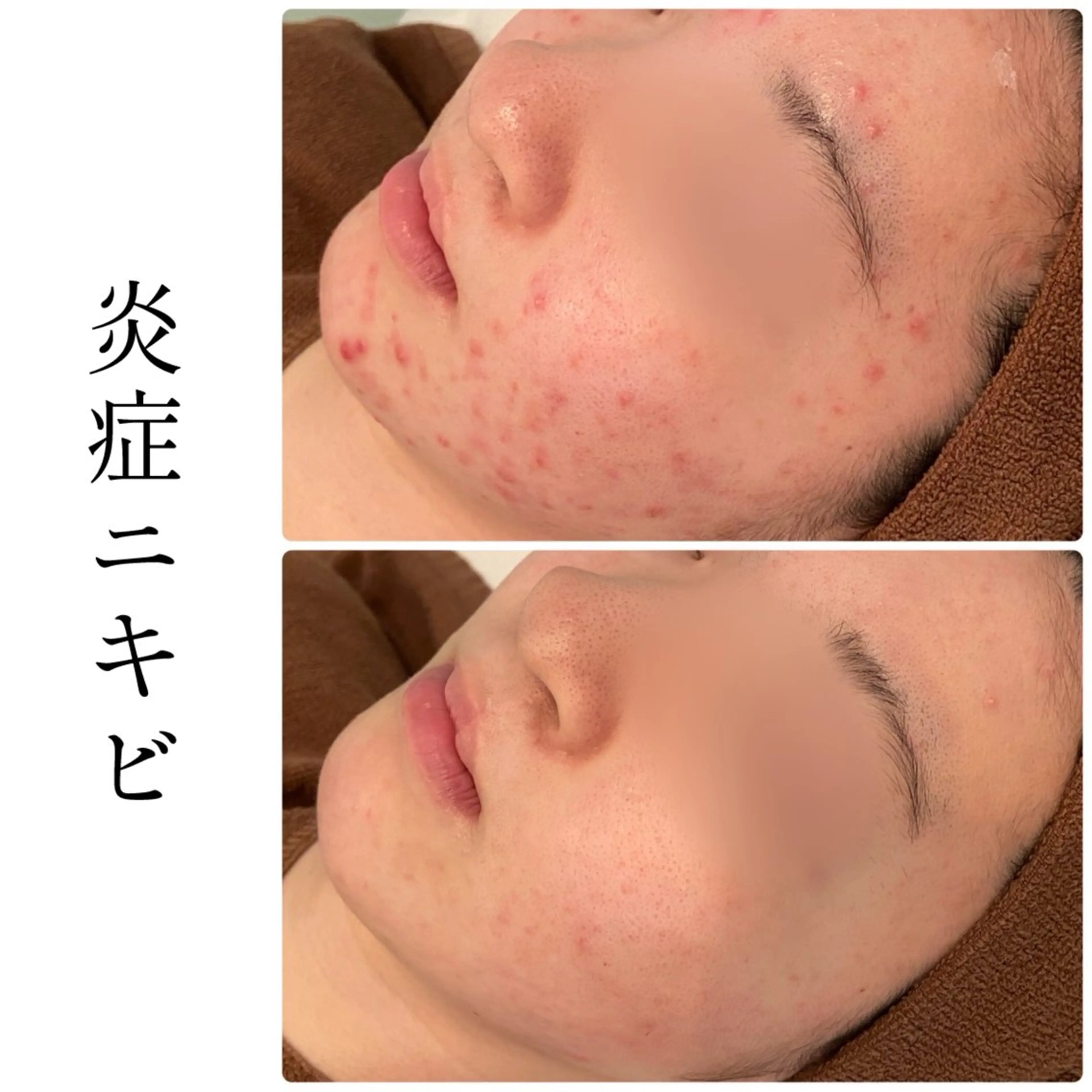 ハーブピーリング専門 BIOEL横浜のエステ・リラクイメージ