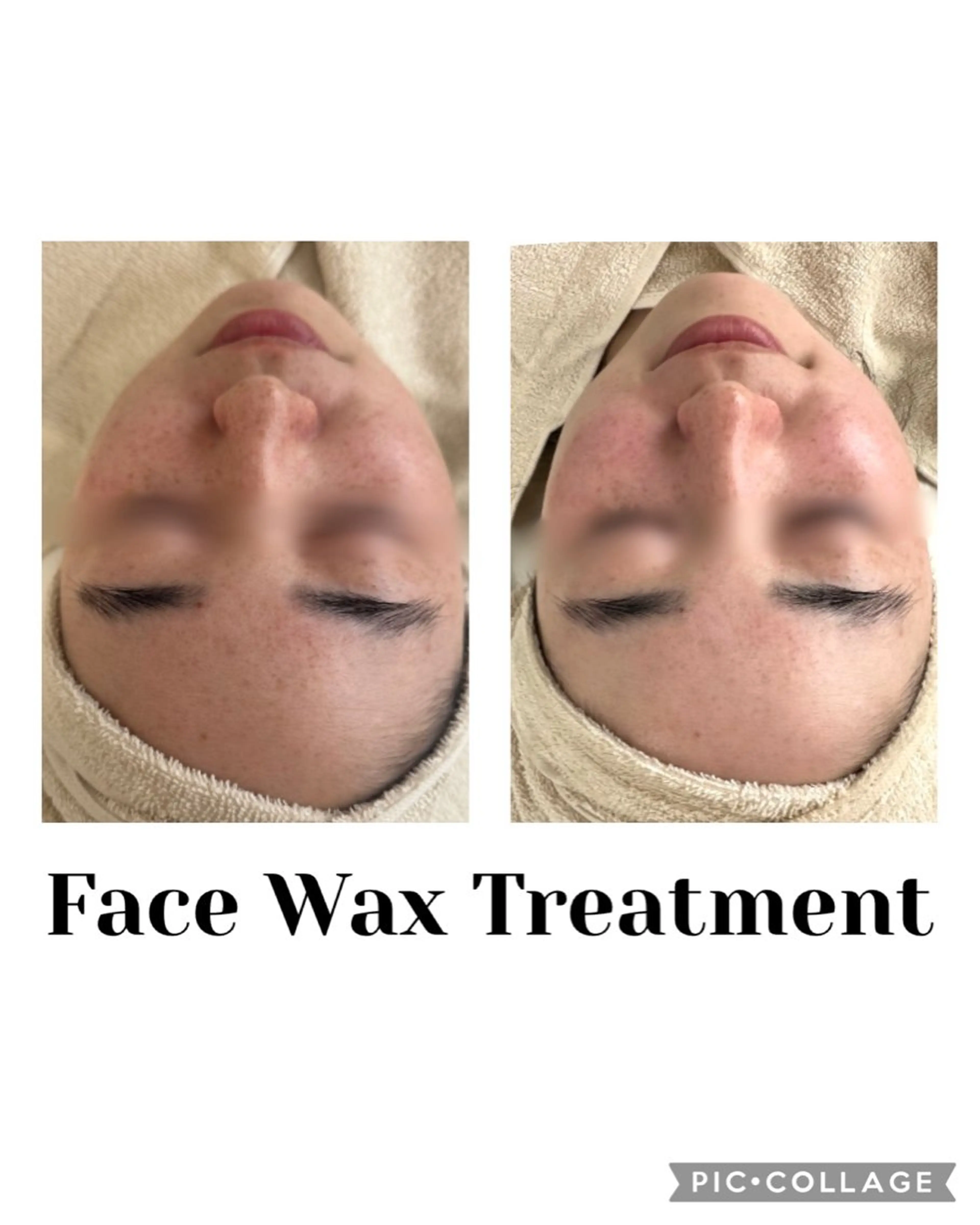 リラク 韓国肌管理 白玉肌管理®︎のエステ・リラクイメージ