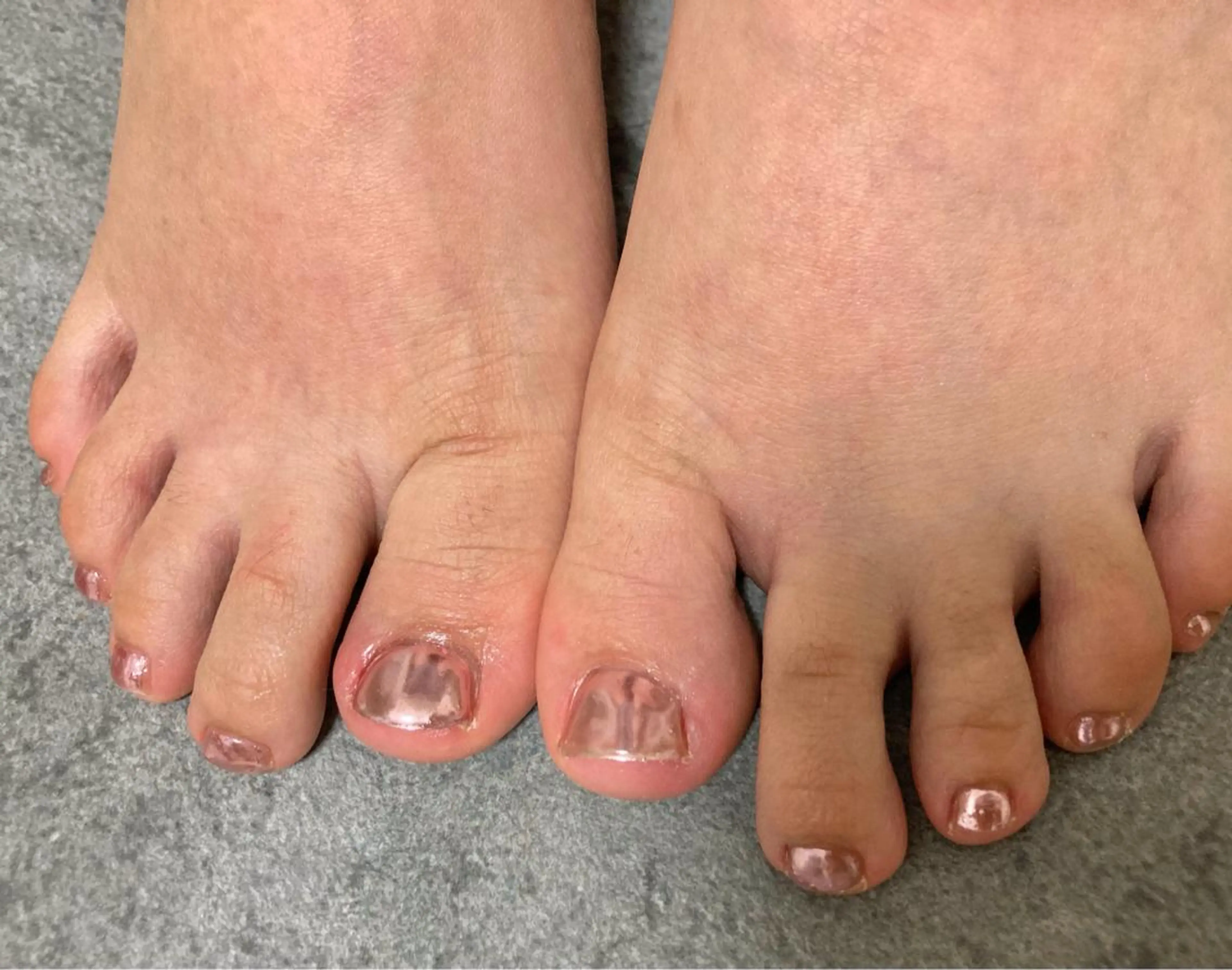 ネイル フットネイル ミラーネイル ピンク ハンドネイル mogunail &blowのネイルデザイン