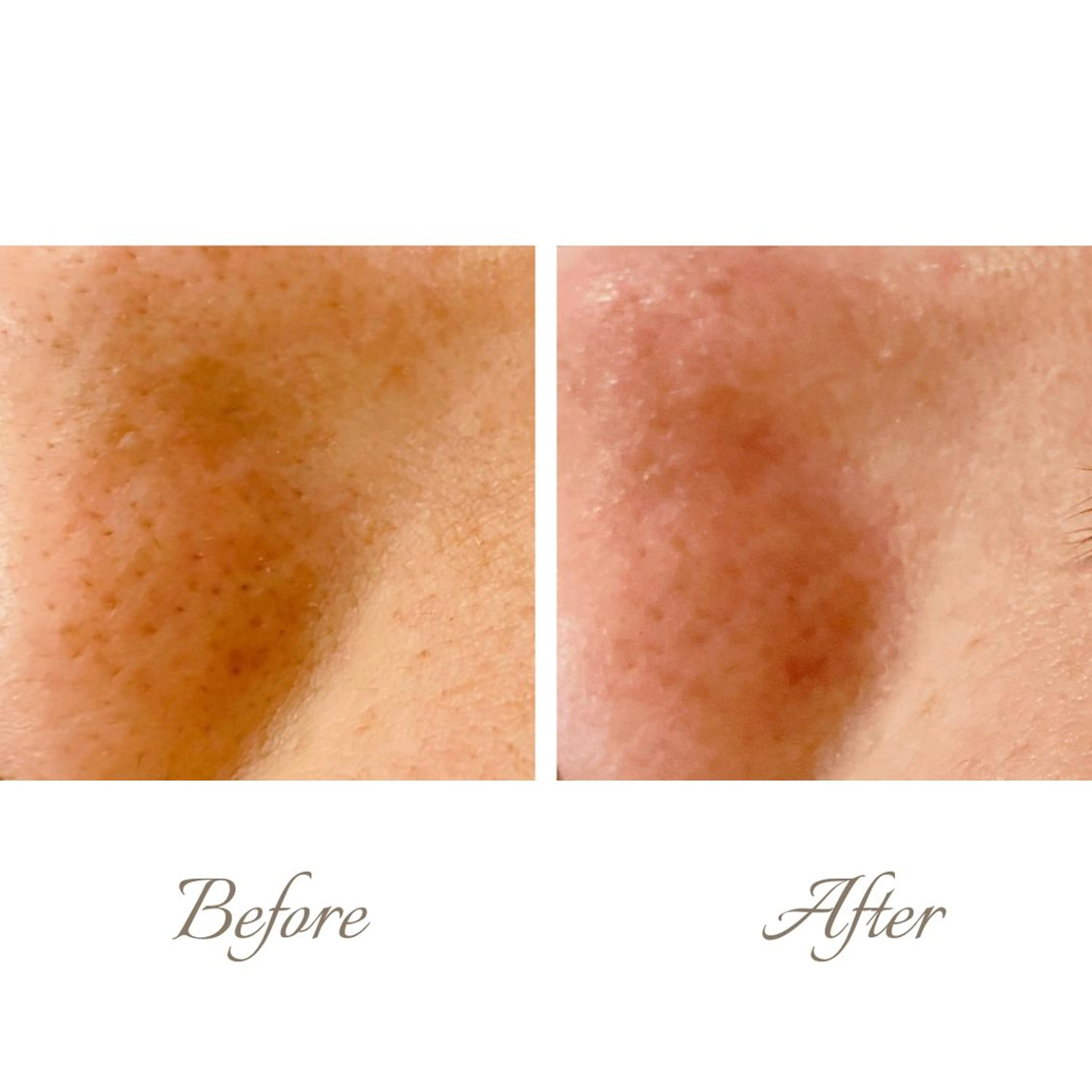 ange rose所属・竹澤 亜希子のエステ・リラクイメージ