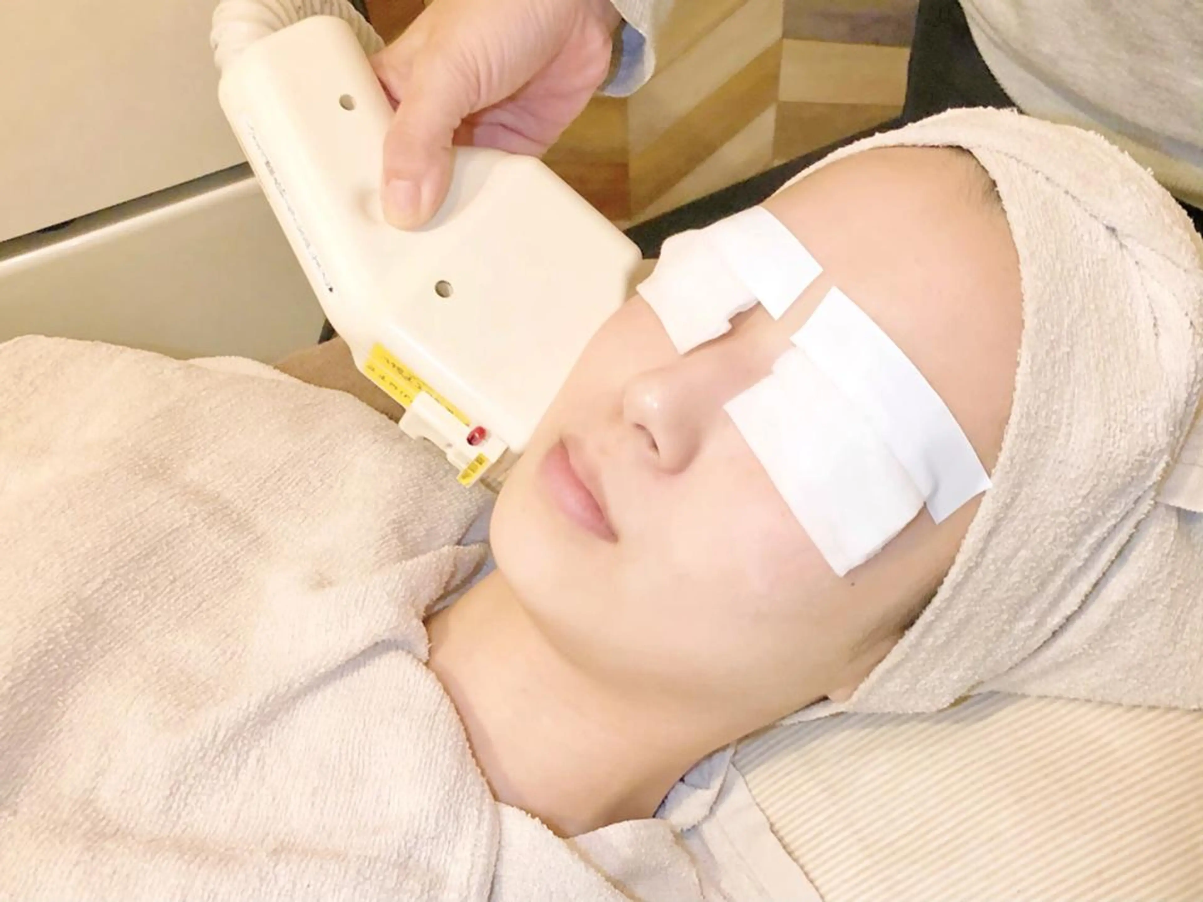 【お肌の基礎力を上げる】顔脱毛（光フォト美顔）【産毛脱毛トーンアップ！化粧ノリも◎】の写真