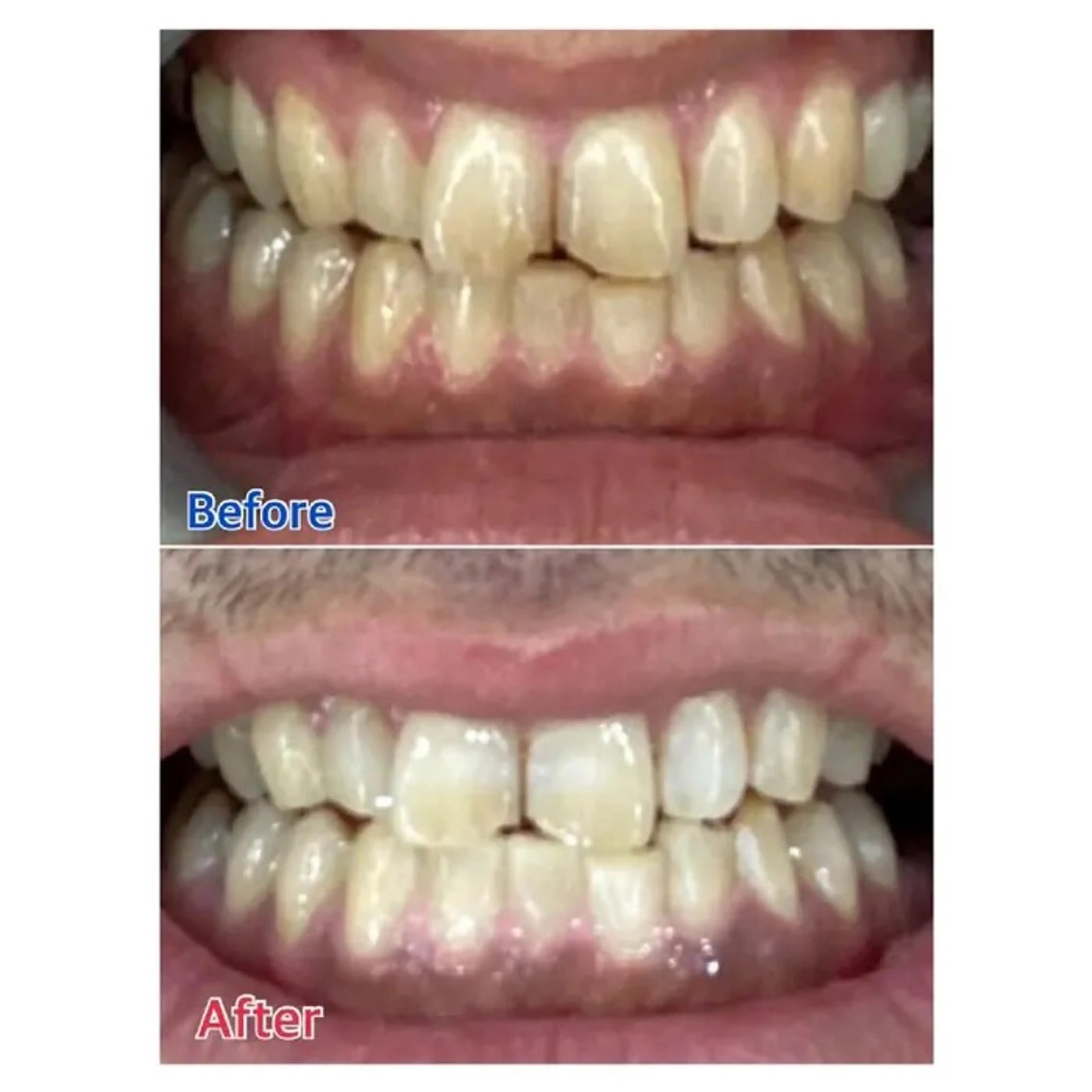 M渋谷 ホワイトニングのエステ・リラクイメージ