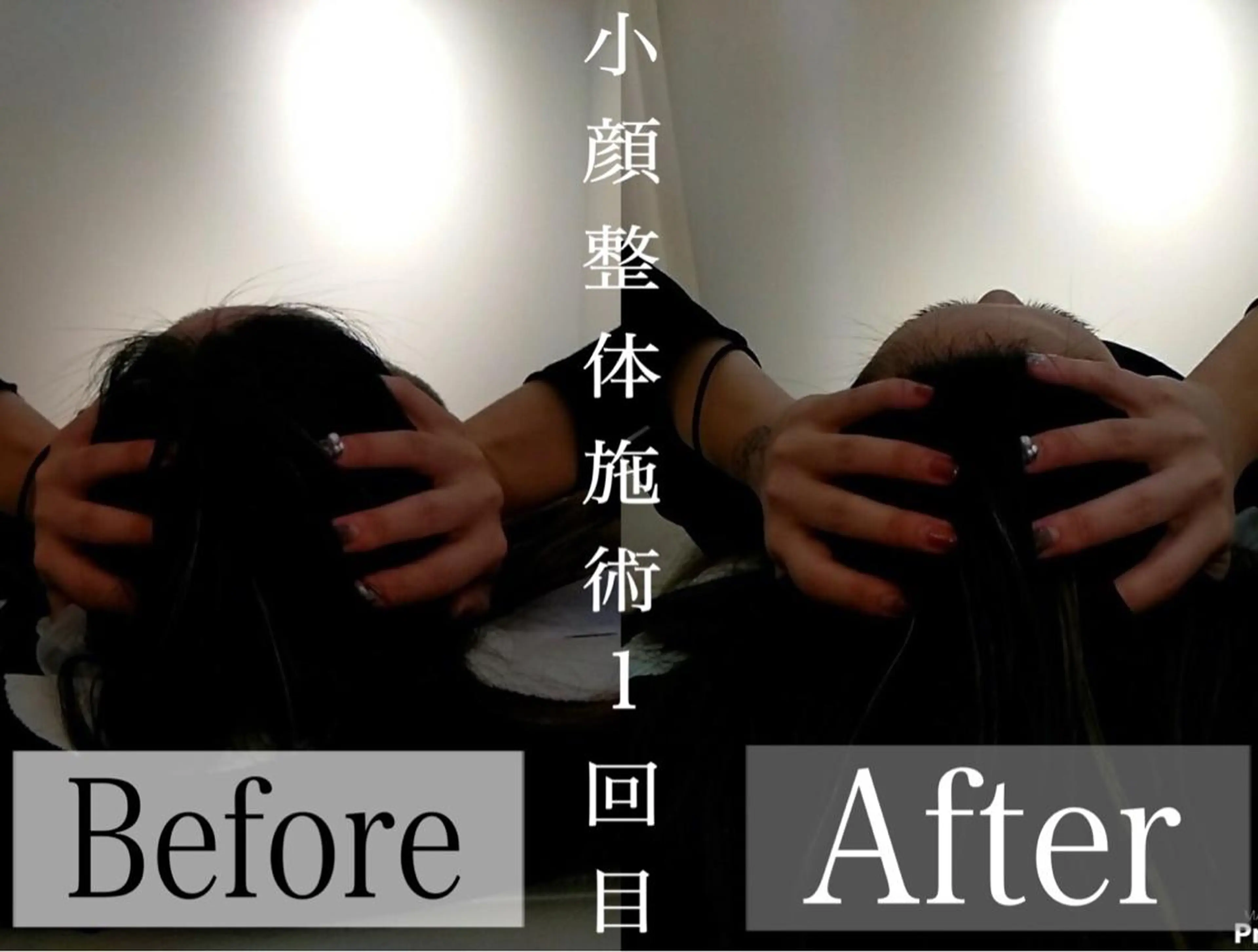 鍼灸 Refineのその他イメージ