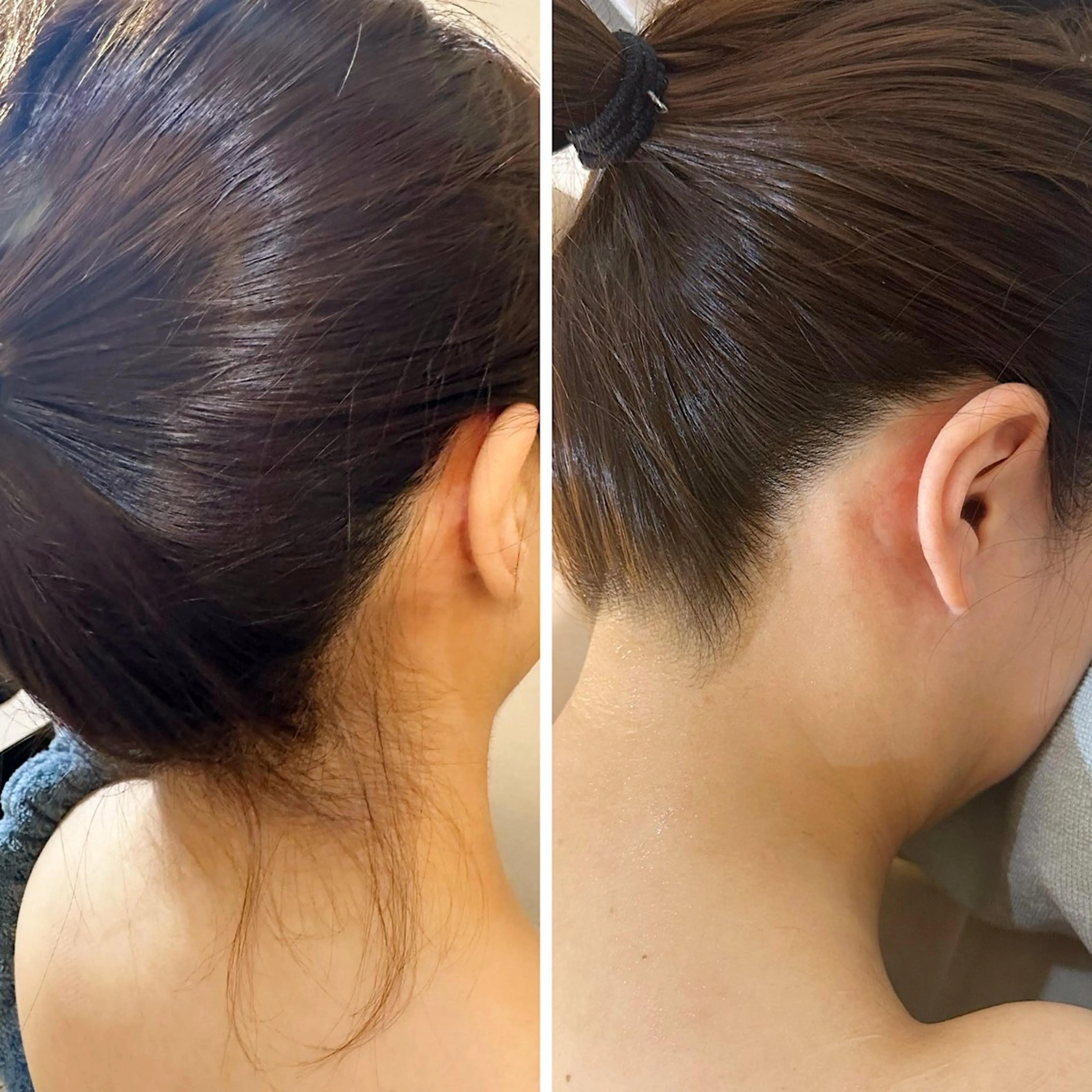 脱毛 うなじ脱毛/美肌脱毛 LABELのエステ・リラクイメージ