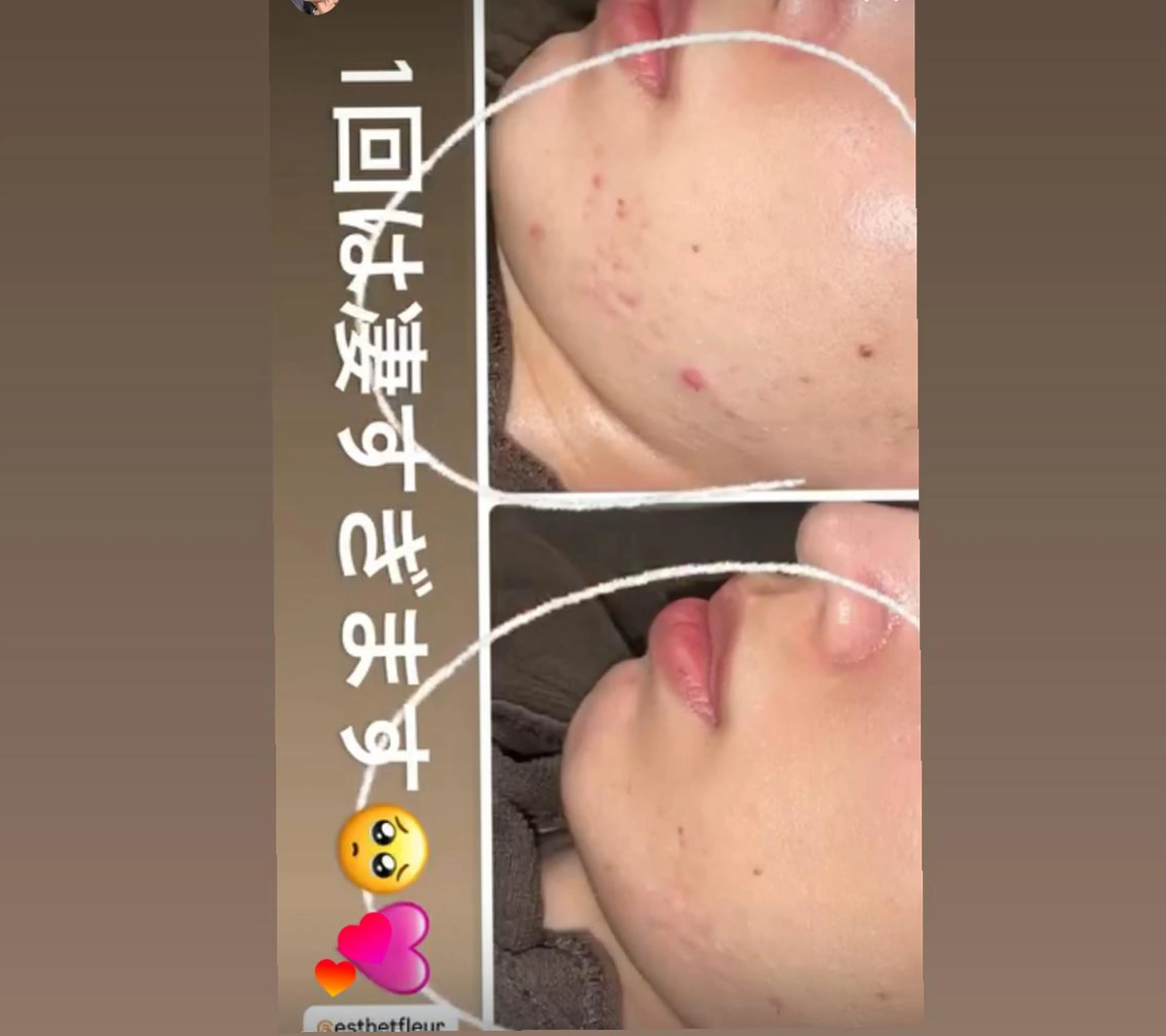 FLEUR 2号店のエステ・リラクイメージ