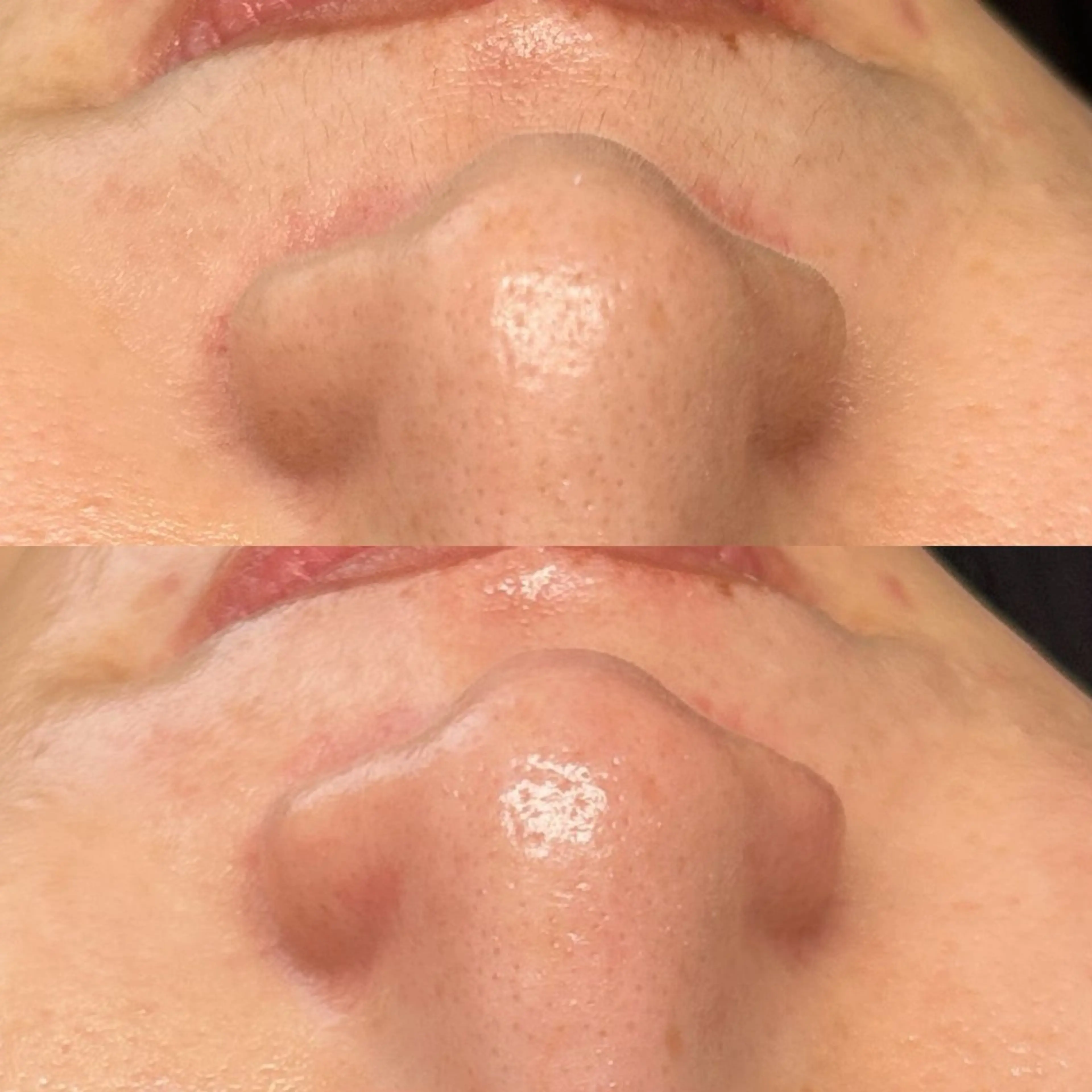 Le cherienのエステ・リラクイメージ