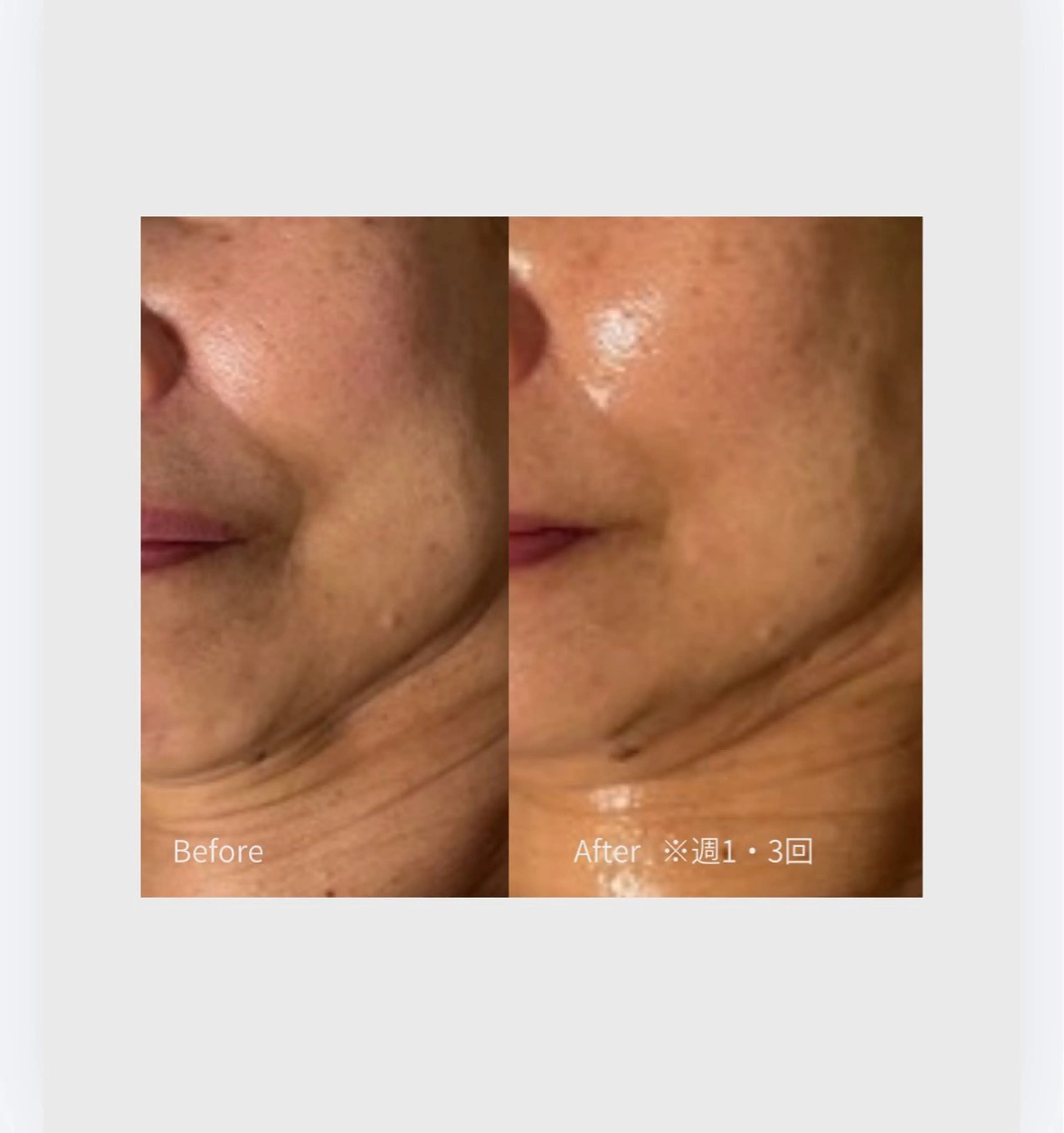 肌管理フェイシャル Utoutoのエステ・リラクイメージ