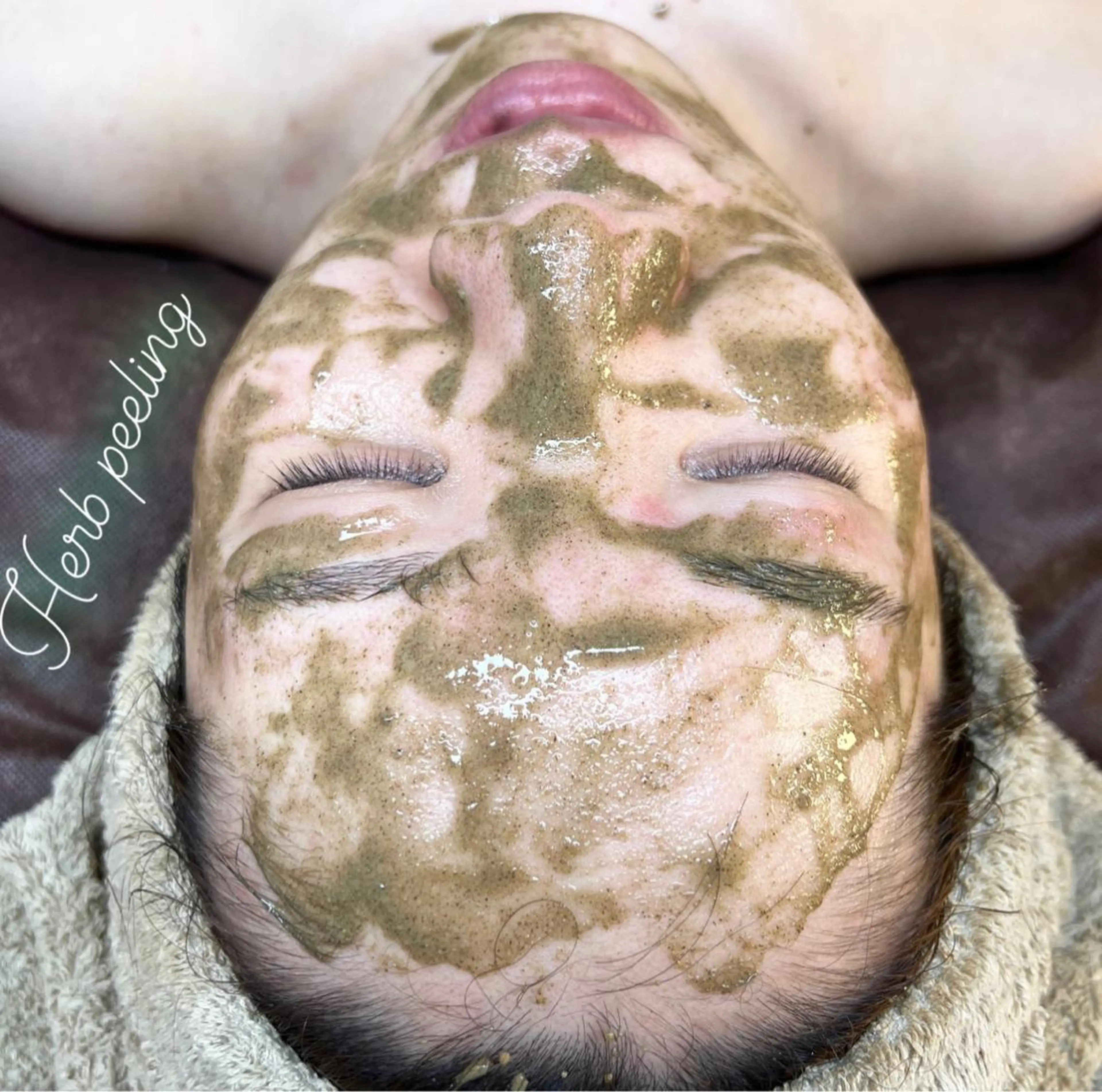 ⭐️おすすめ⭐️【剥けない&痛くない】ハーブピーリング🌿肌質改善 200種類国産ハーブ使用🌿‬メイク可🧡パック付きの写真