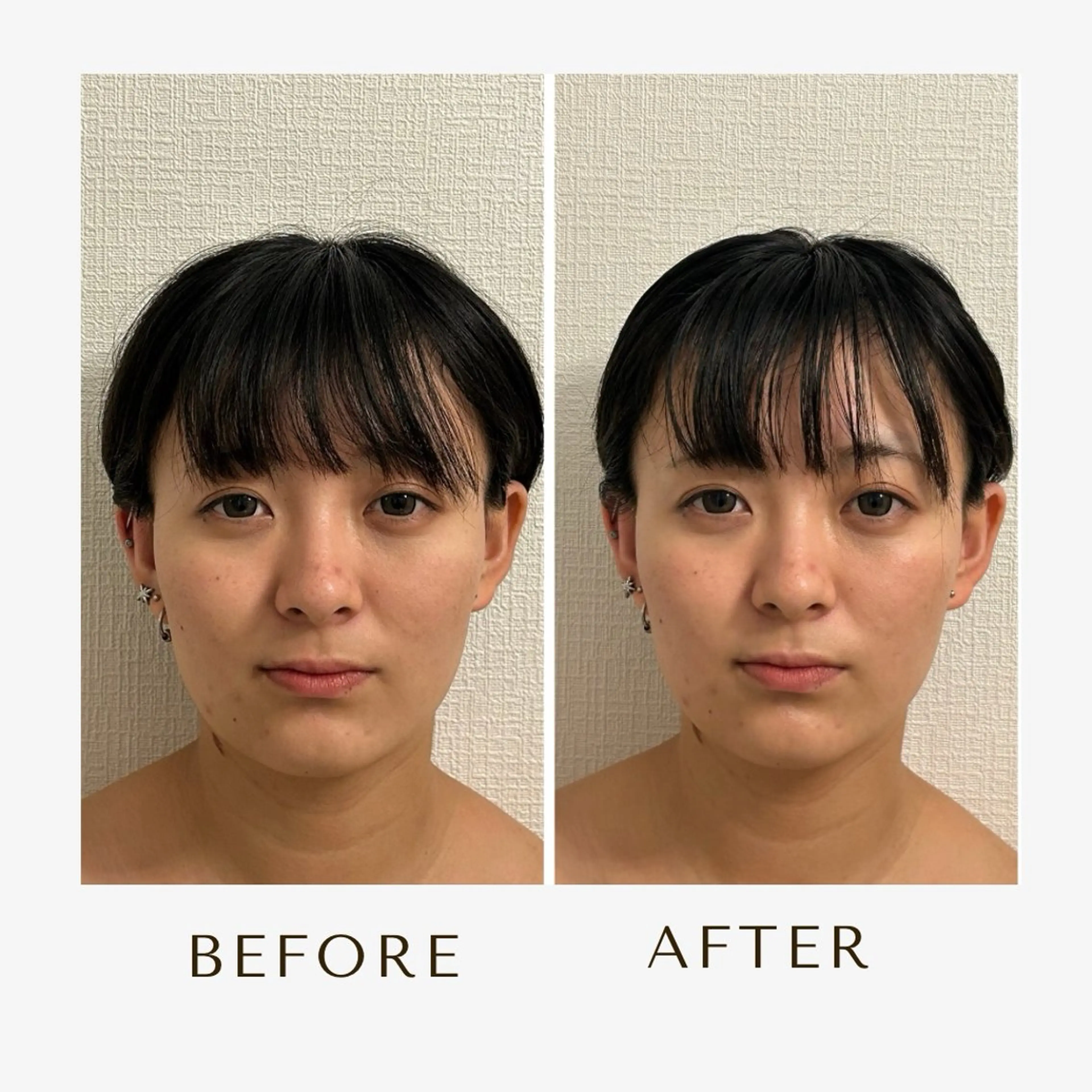 小顔セラピー LILのエステ・リラクイメージ