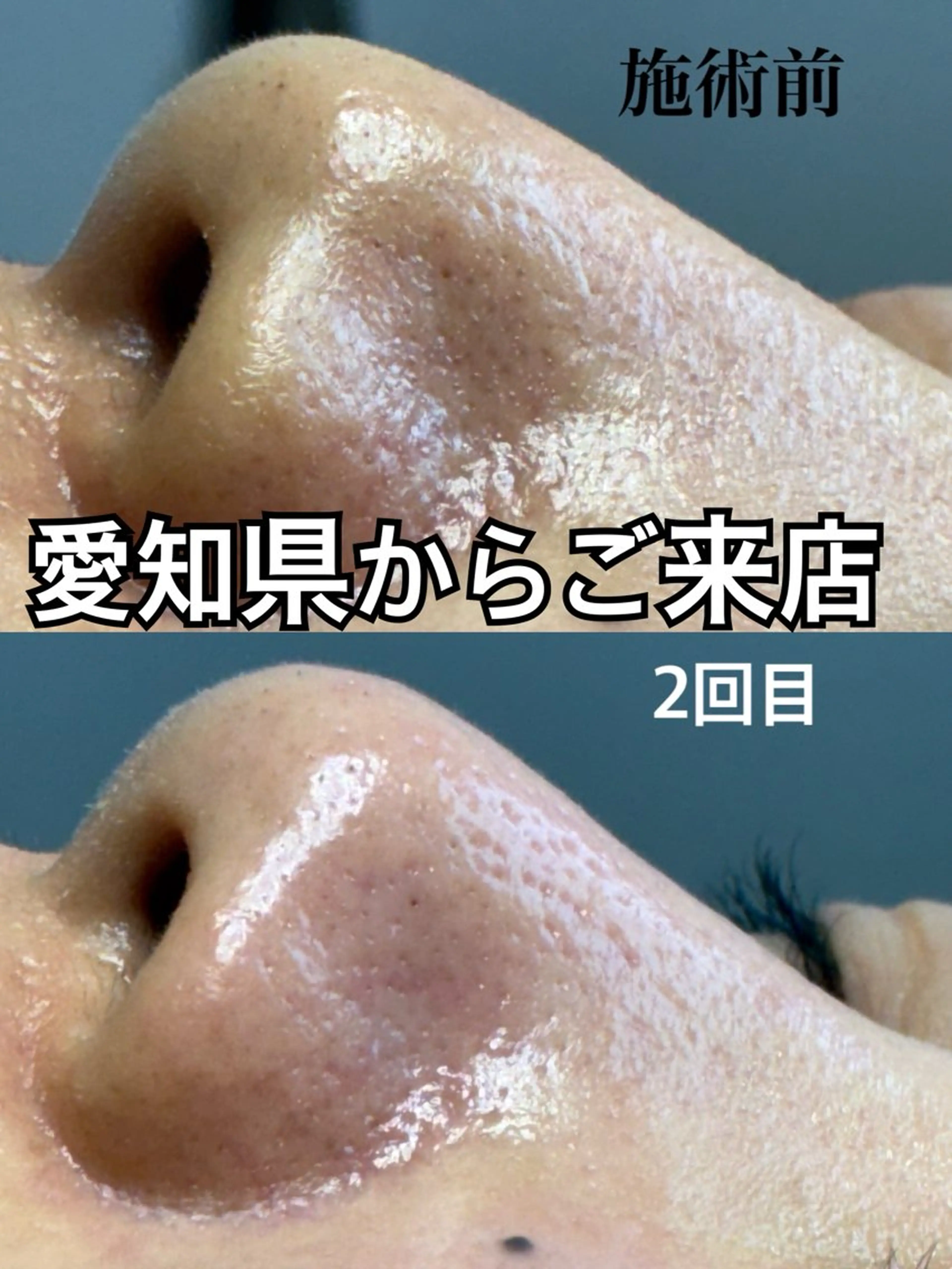 エステ 小林 菜月のエステ・リラクイメージ