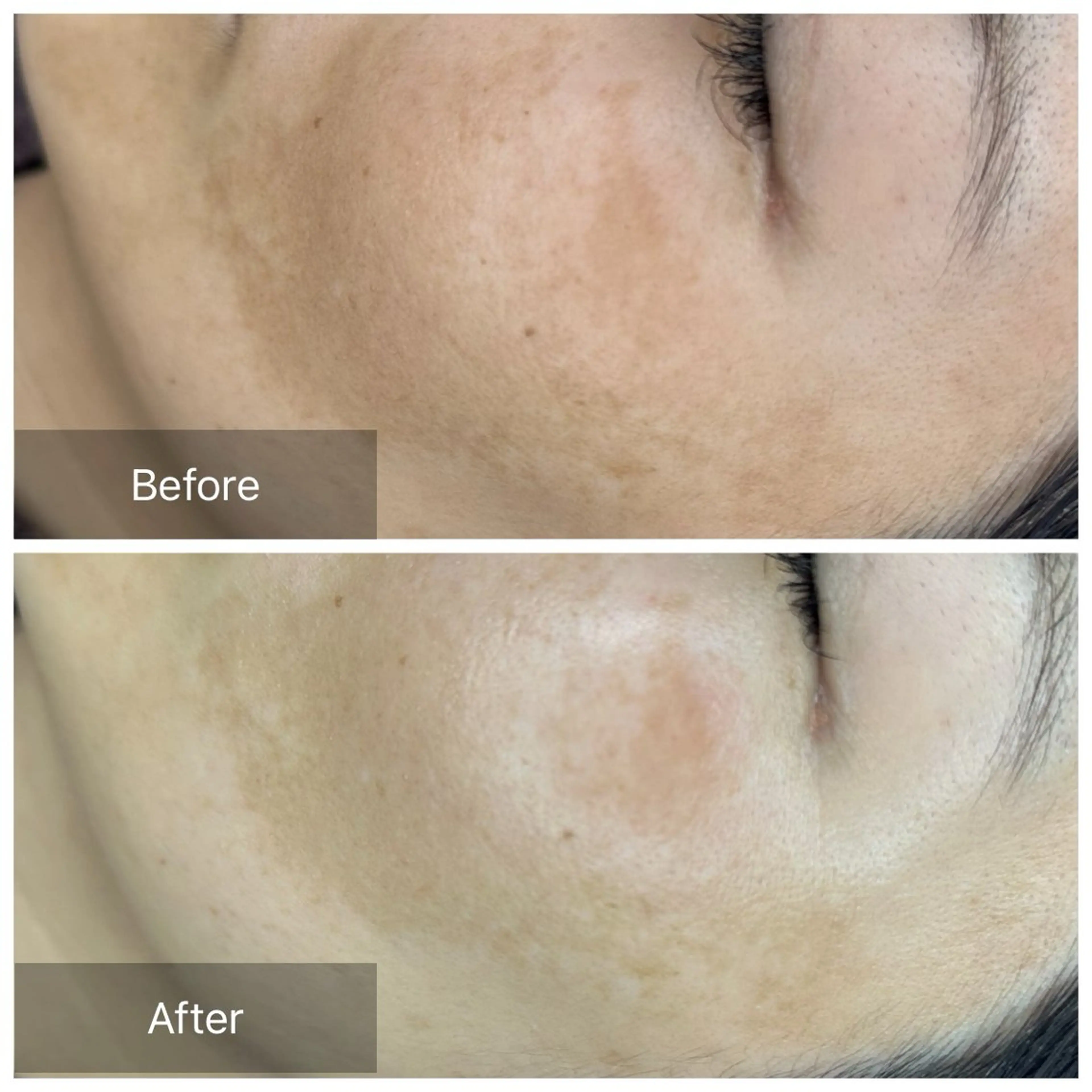 エステ トータルしみケア専門 NICA(ニカ)の眉毛・アイブロウイメージ