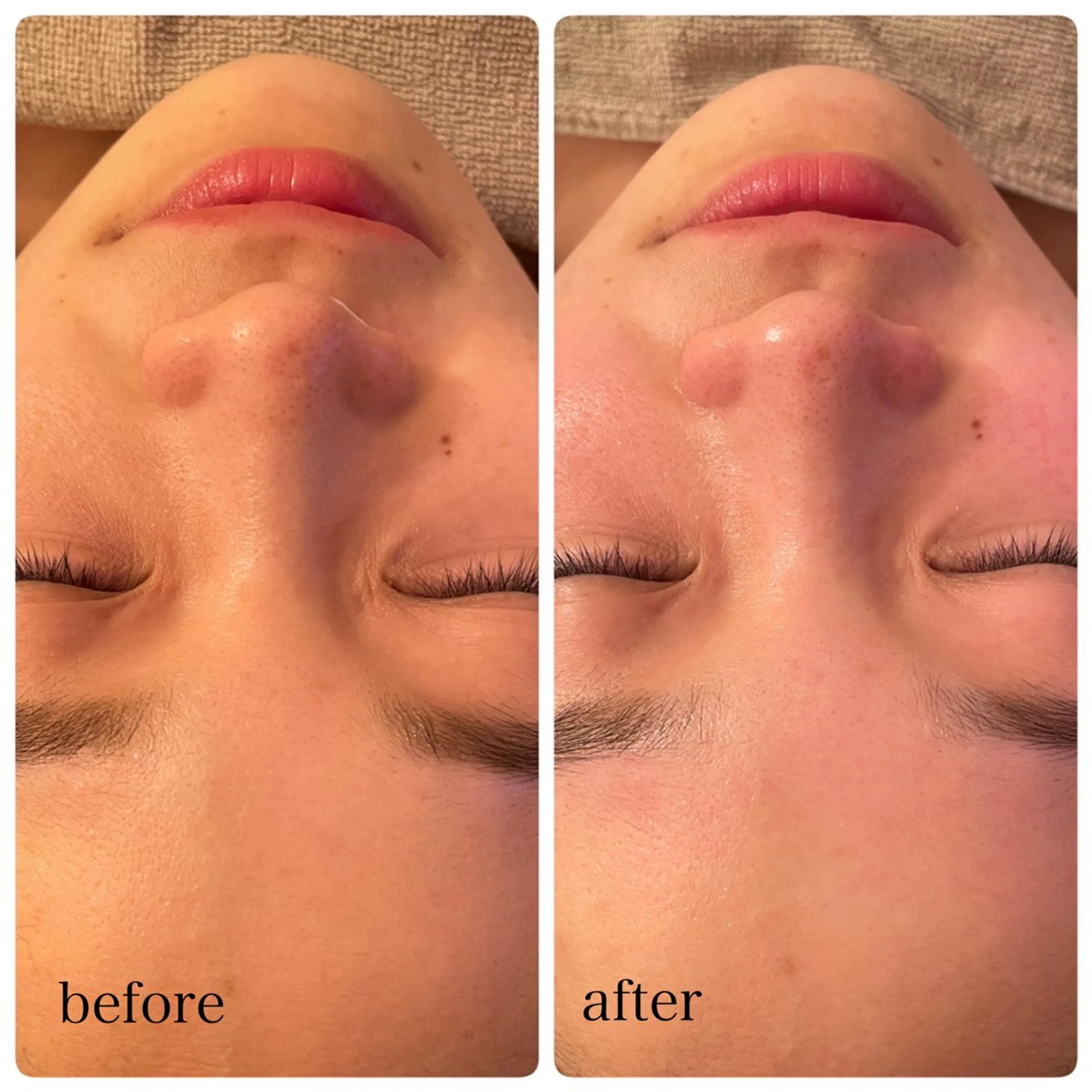 LONO  by a little所属・LONO byalittleのエステ・リラクイメージ