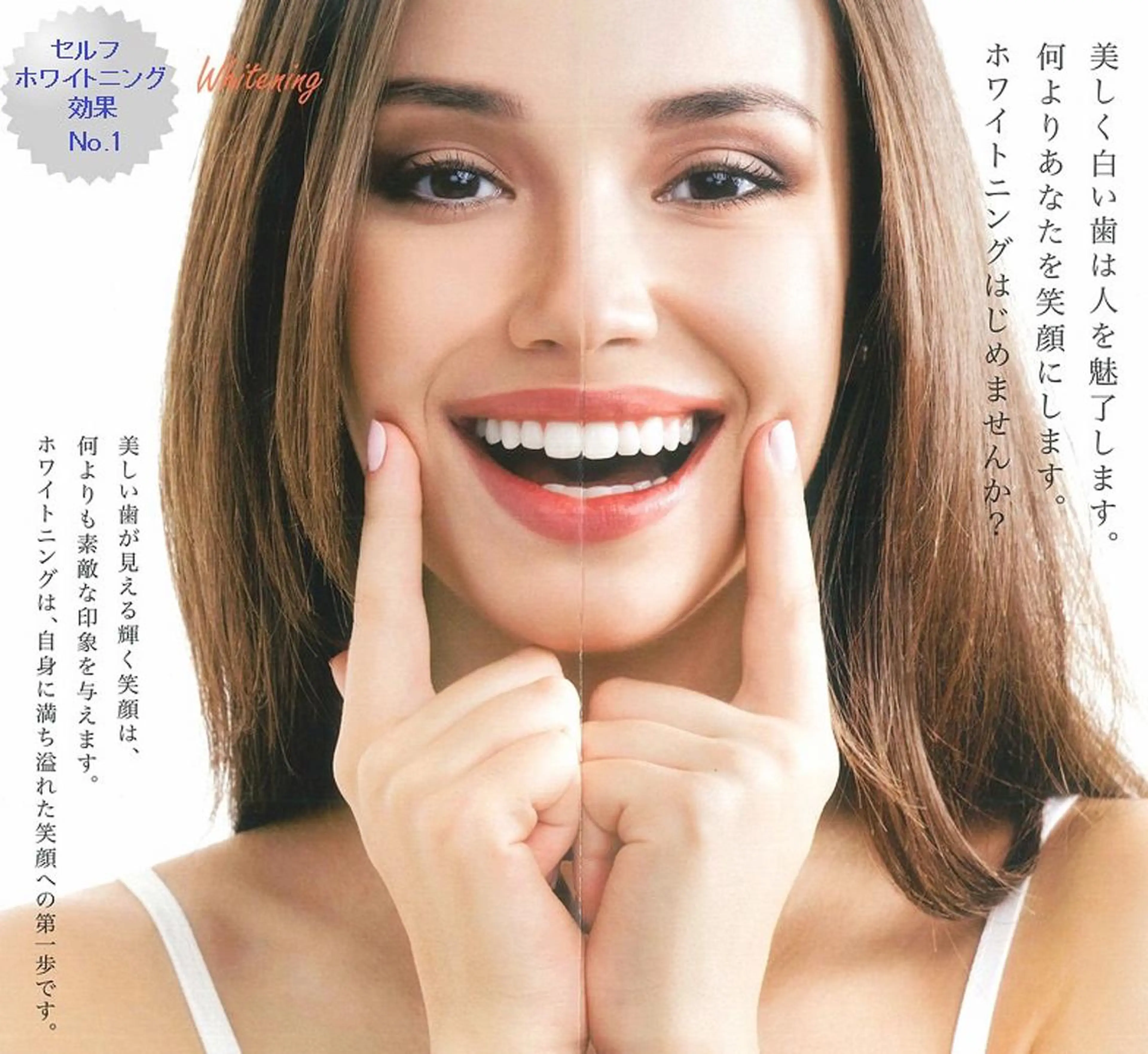 セルフホワイトニング  15分照射×2回の写真