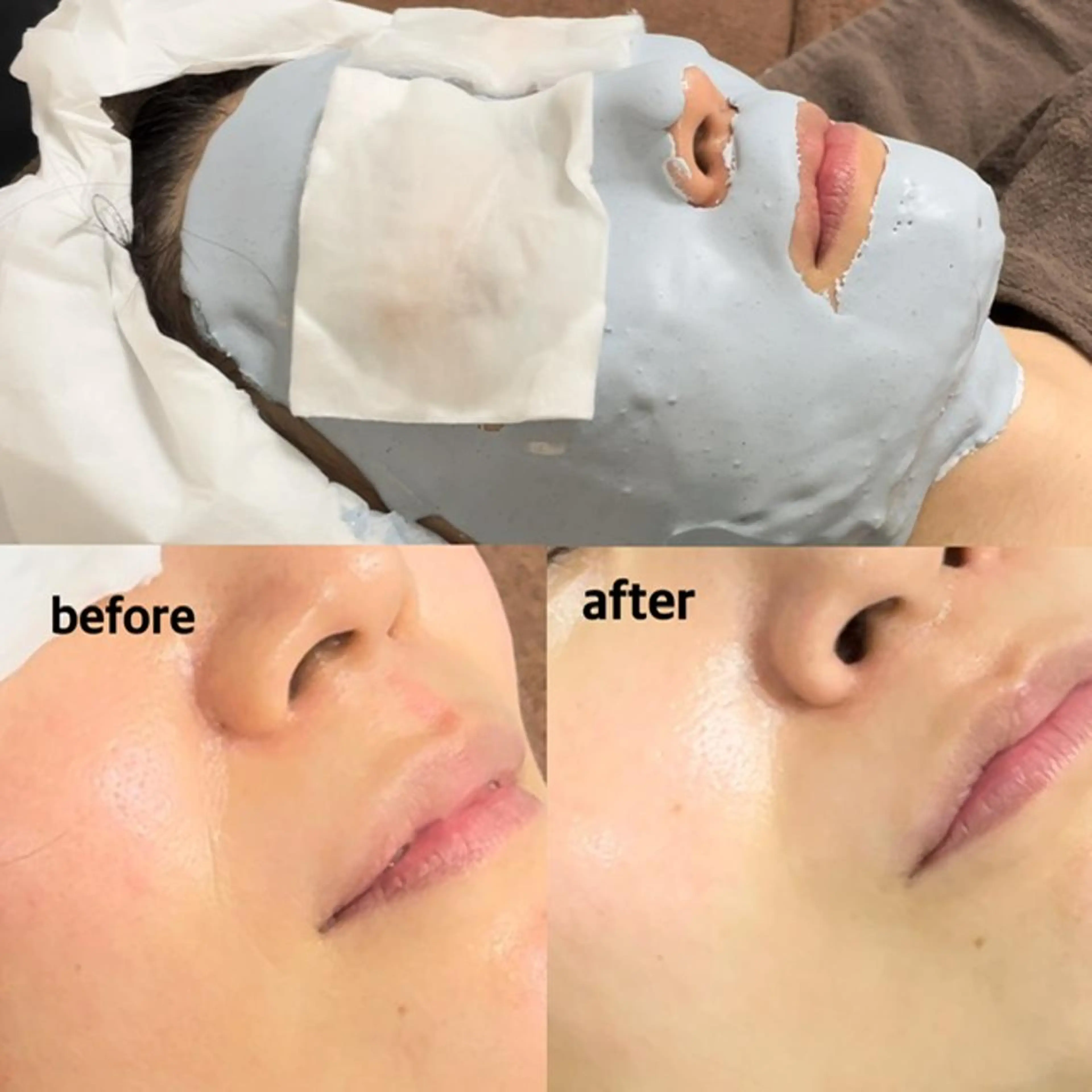 肌ケア&毛穴洗浄 Cheri/女性専用のエステ・リラクイメージ