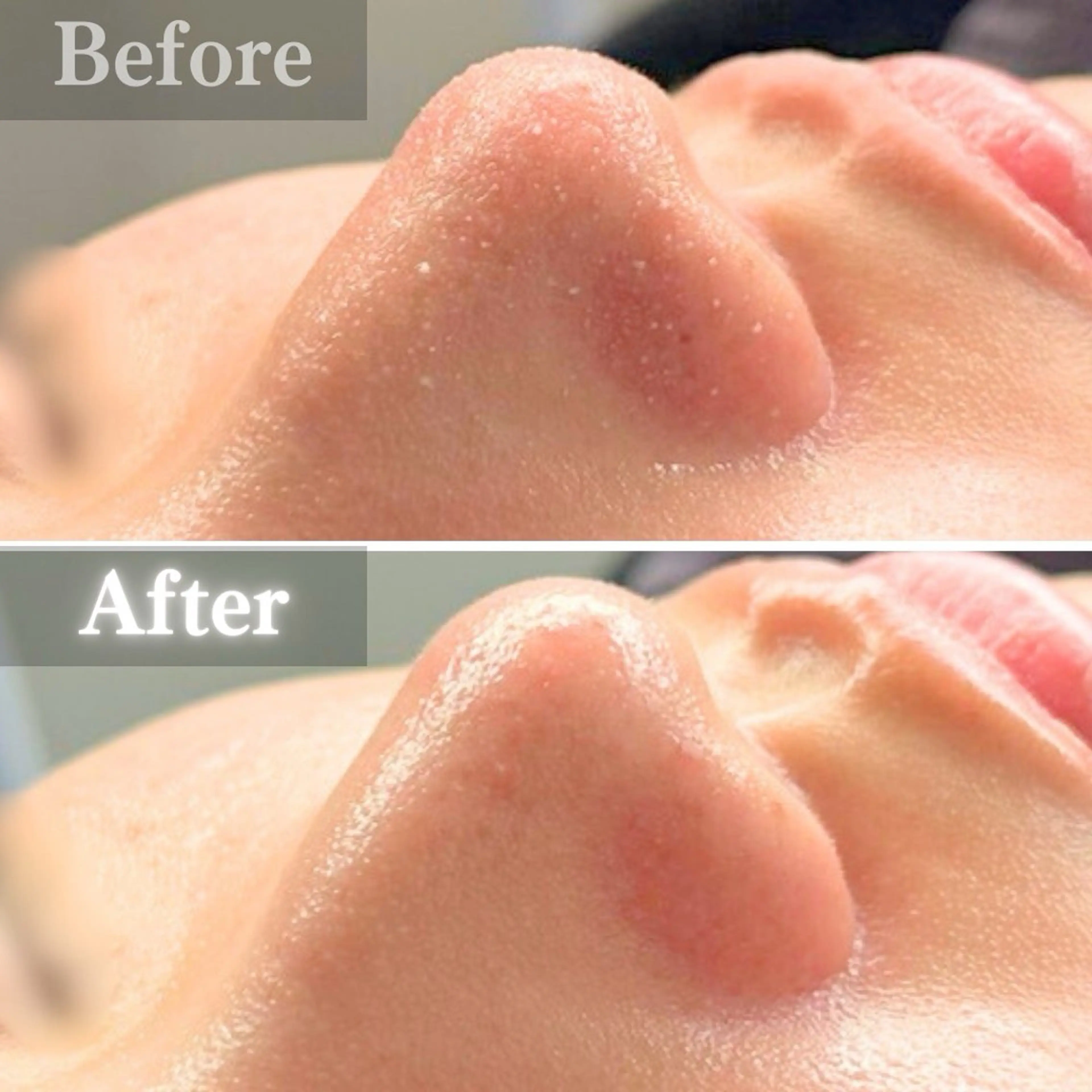 エステ 毛穴洗浄特化🫧 オオツカのエステ・リラクイメージ