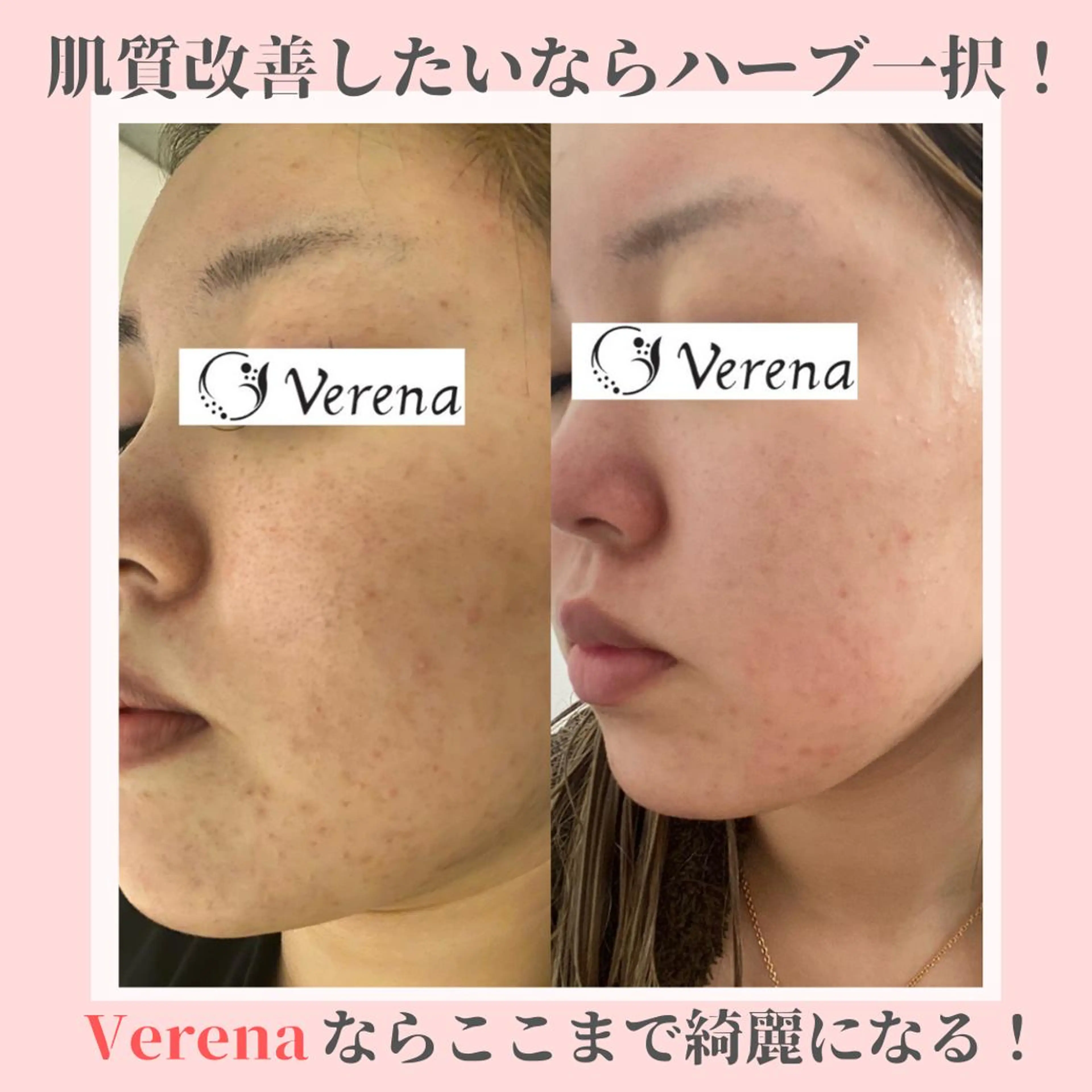 ピーリング専門店 Belluteのエステ・リラクイメージ