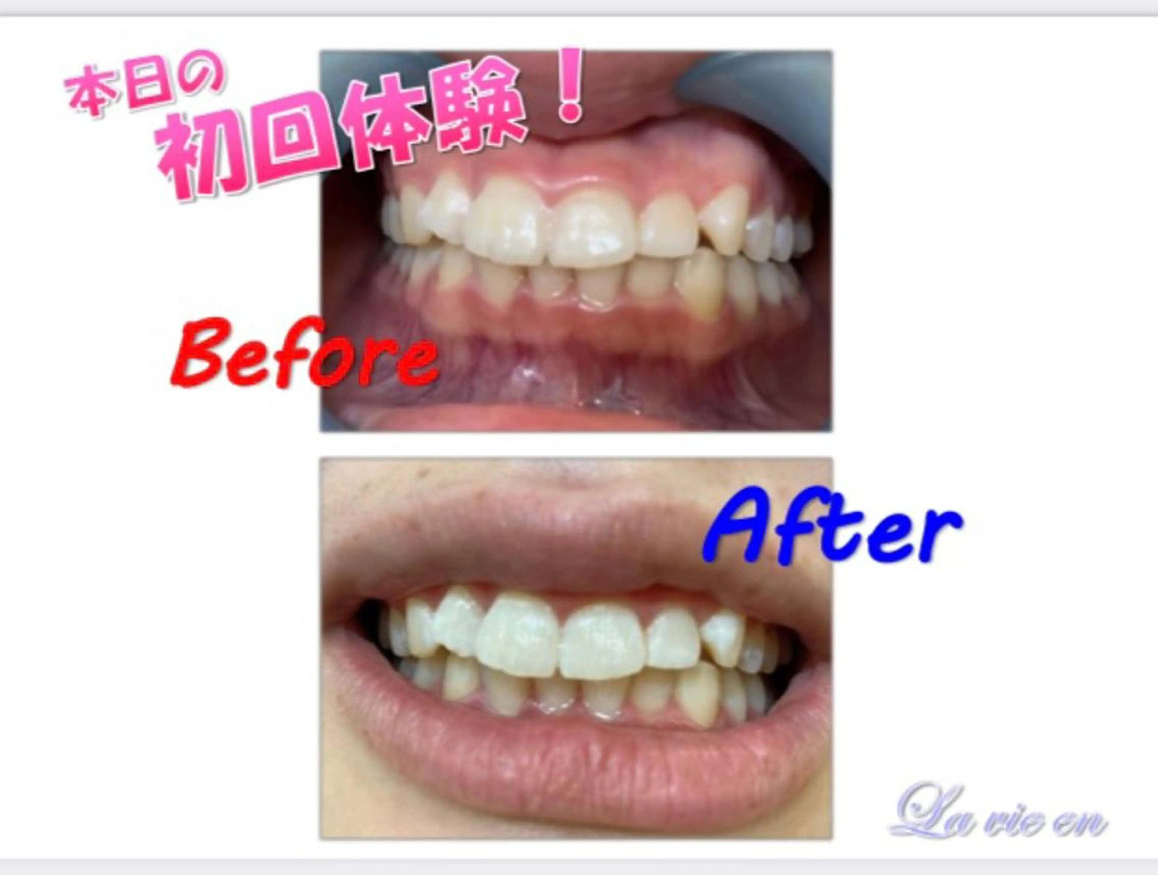 その他 セルフホワイトニングサロン　ラヴィアン所属・ホワイトニングサロン La vie enのその他イメージ