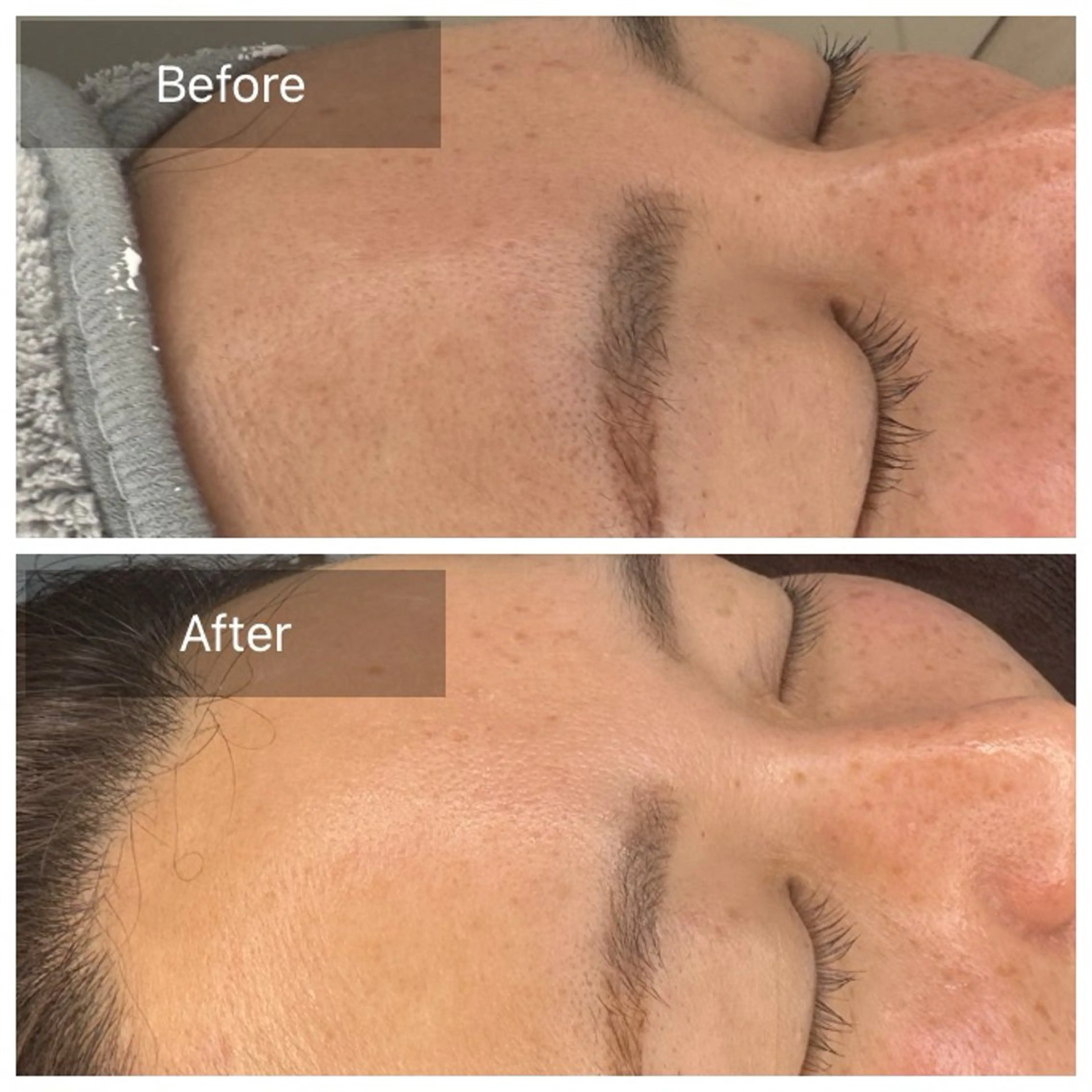 エステ トータルしみケア専門 NICA(ニカ)の眉毛・アイブロウイメージ