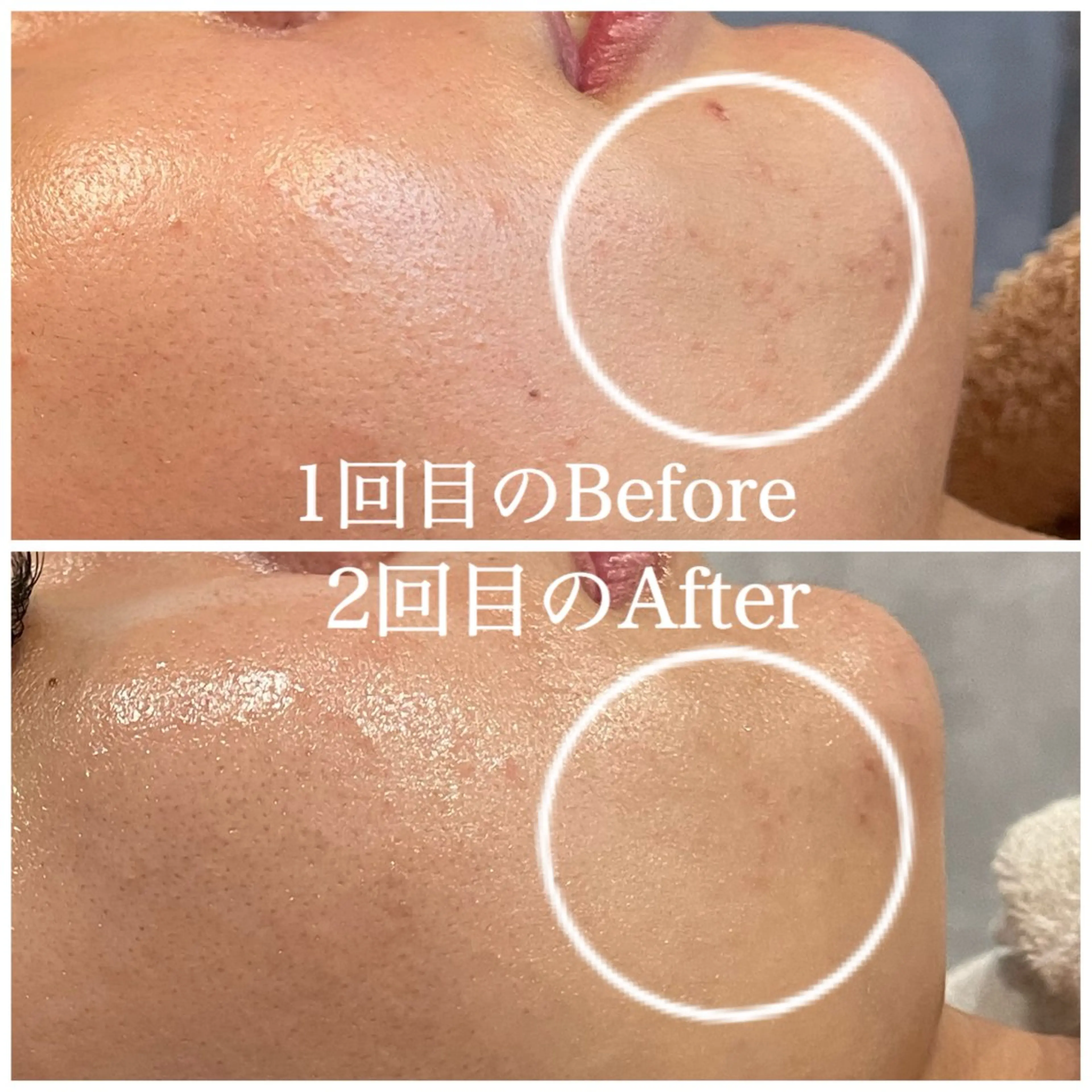 Nna Salon所属・Nna 韓国肌管理のエステ・リラクイメージ