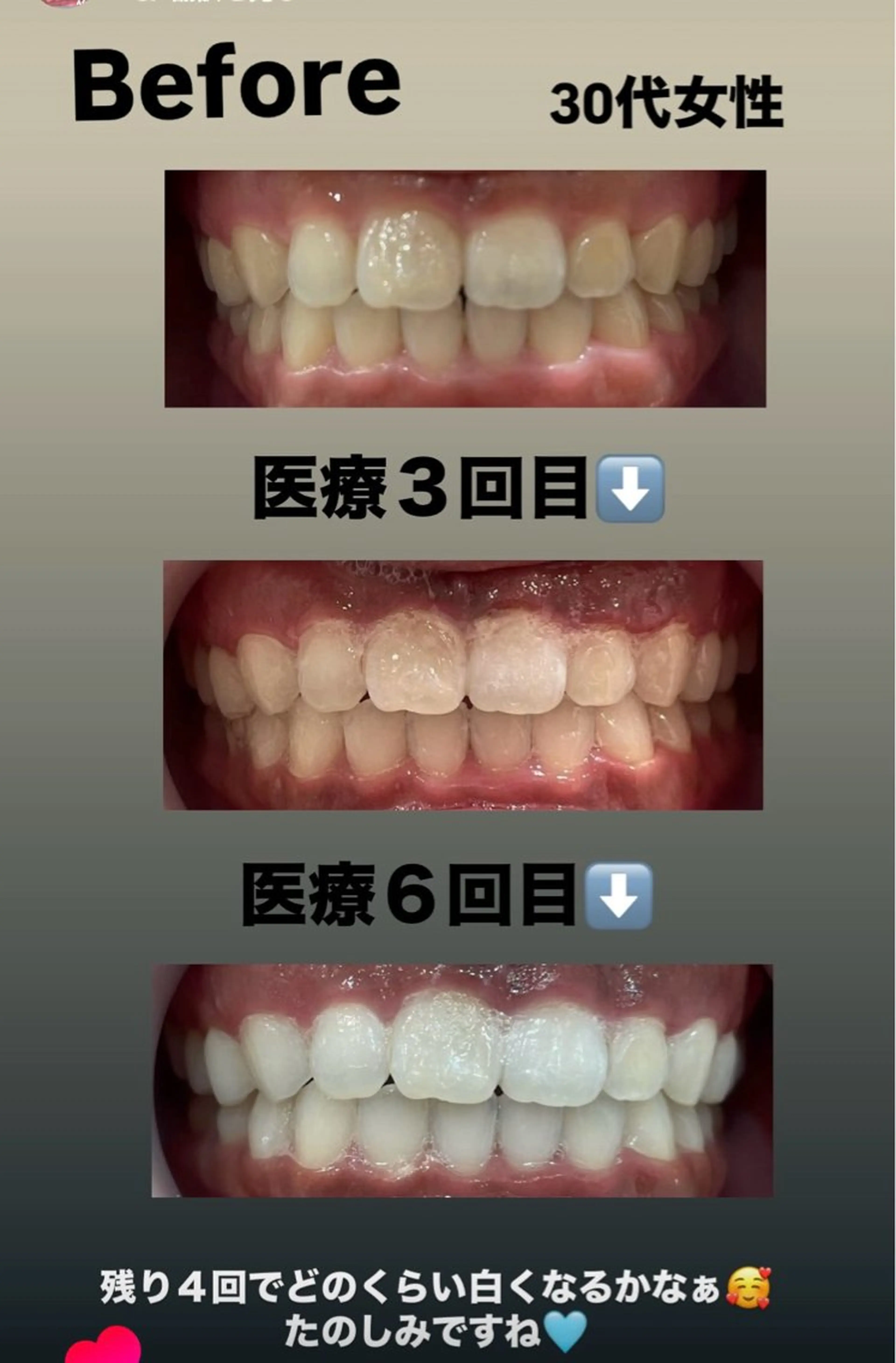 Kaula ホワイトニング🦷✨のエステ・リラクイメージ