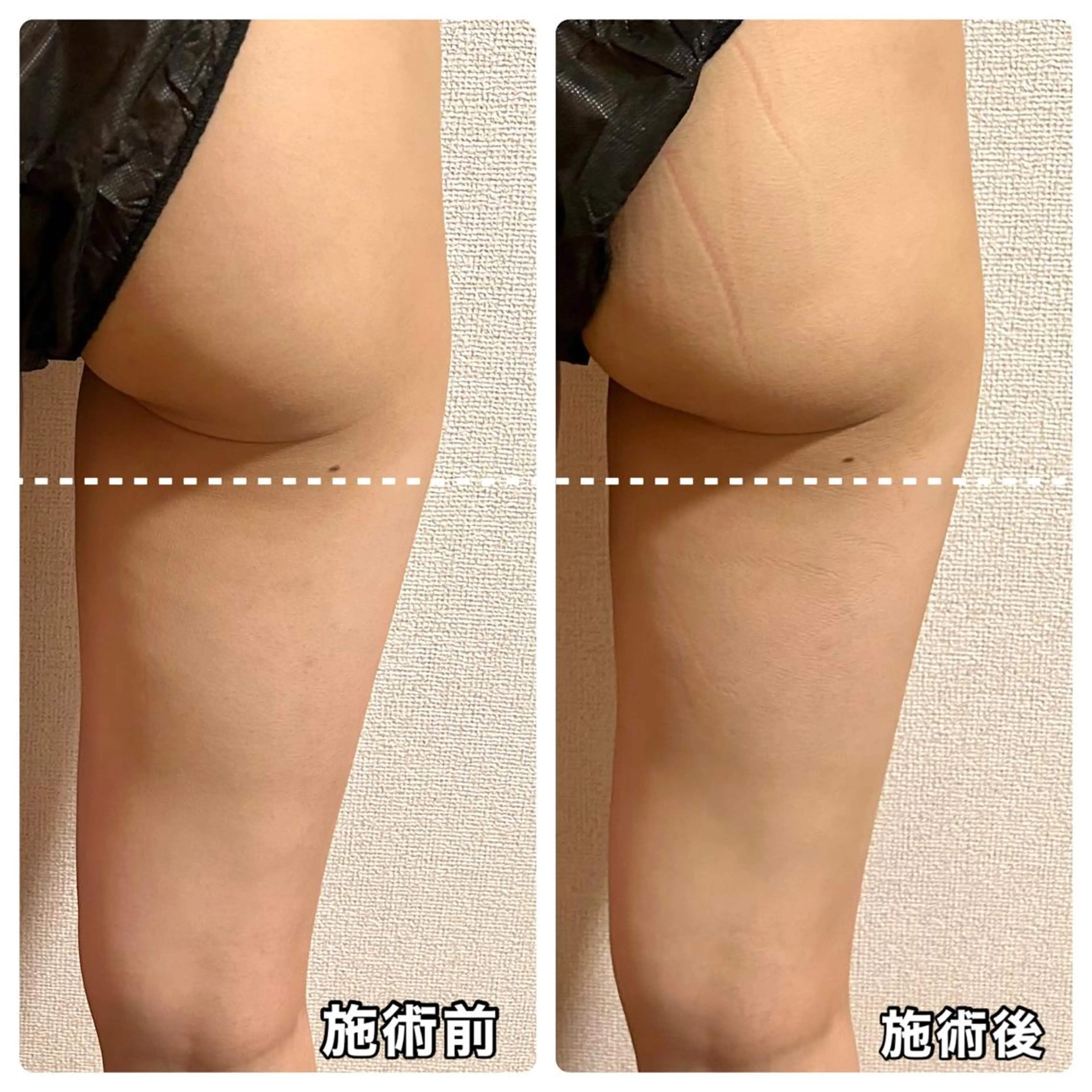 🌴Beauty Salon LANAのエステ・リラクイメージ