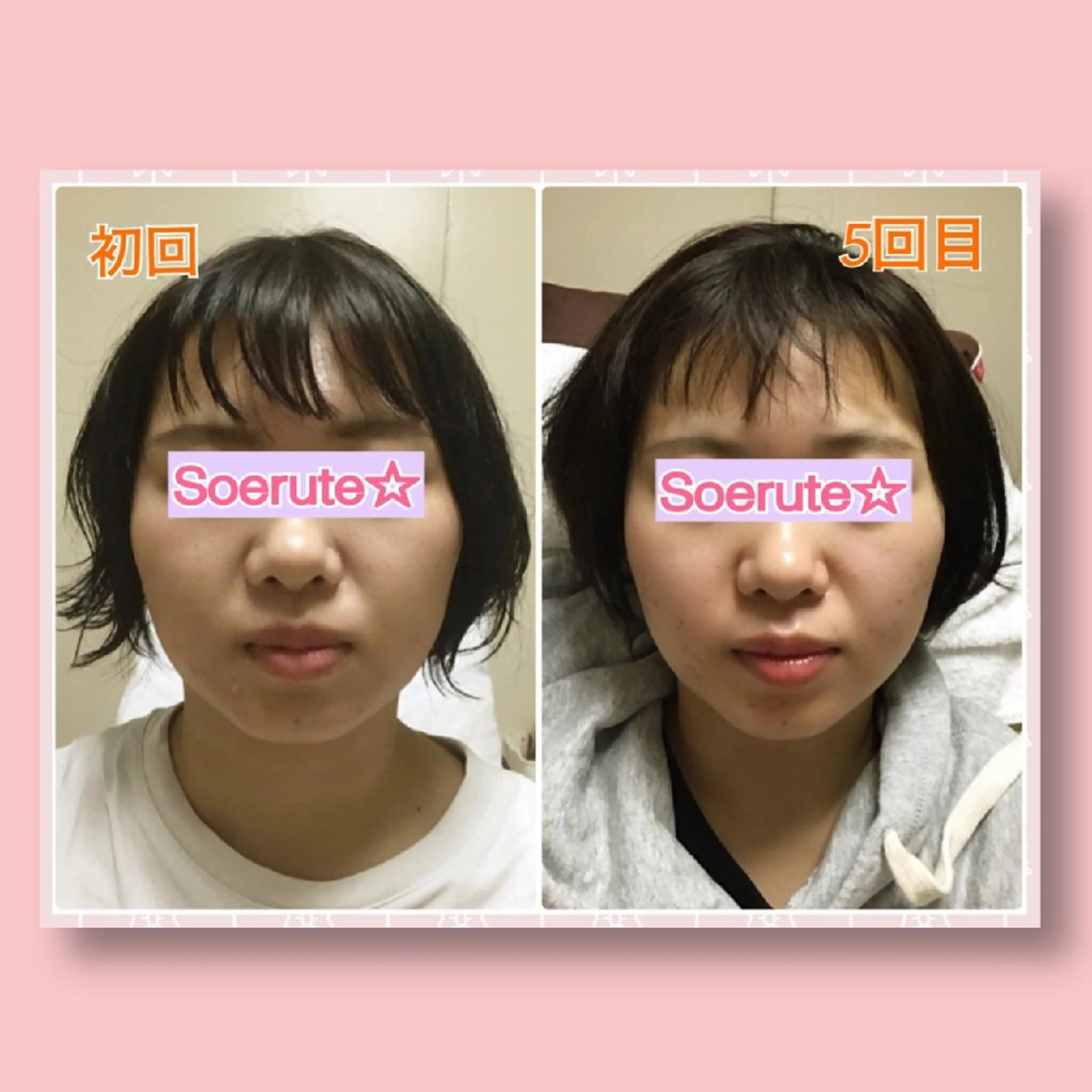 エステ リラク Soerute☆ ソエルテ 井上みえのエステ・リラクイメージ