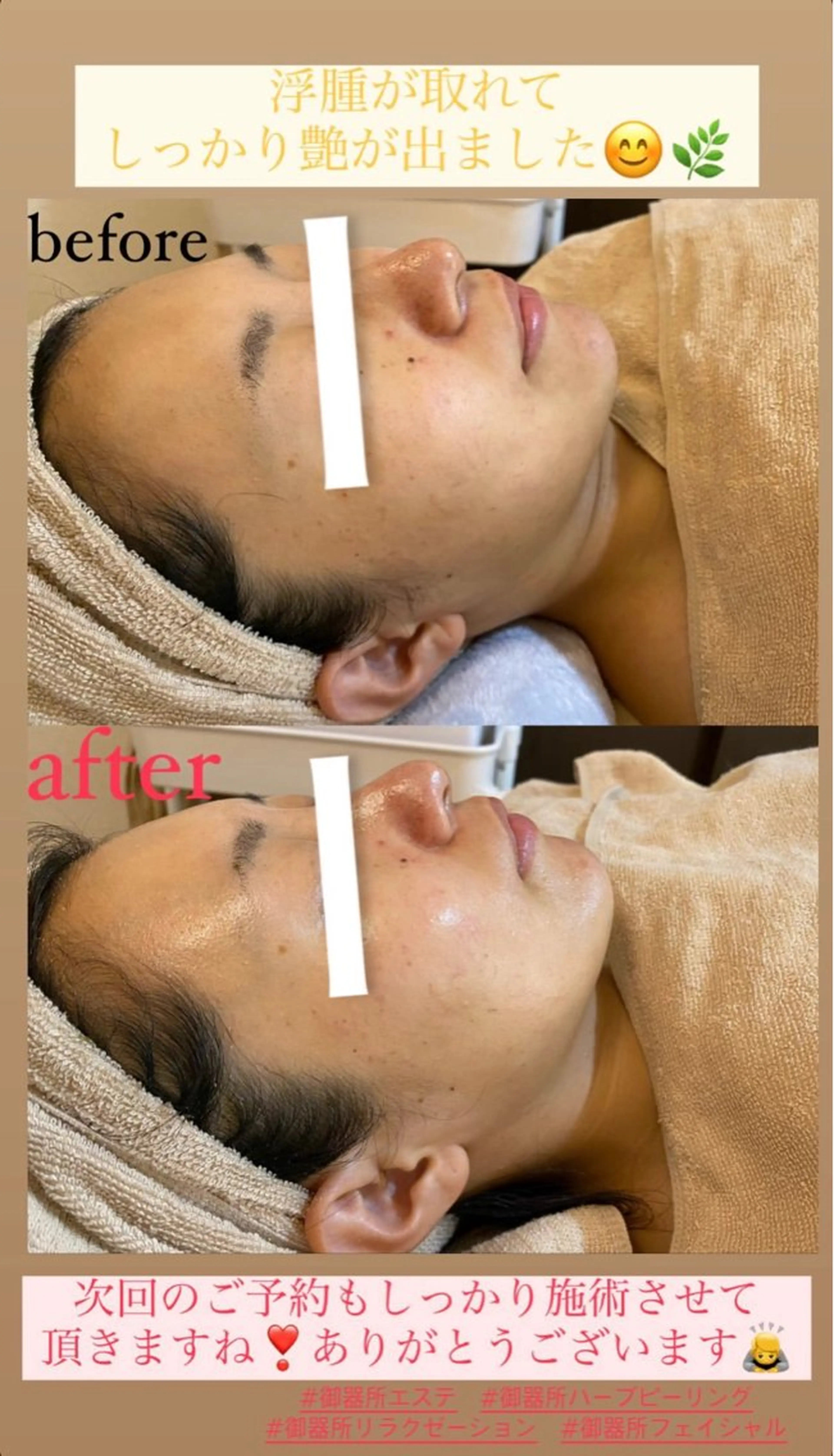 エステ Salon de Lino 御器所のエステ・リラクイメージ