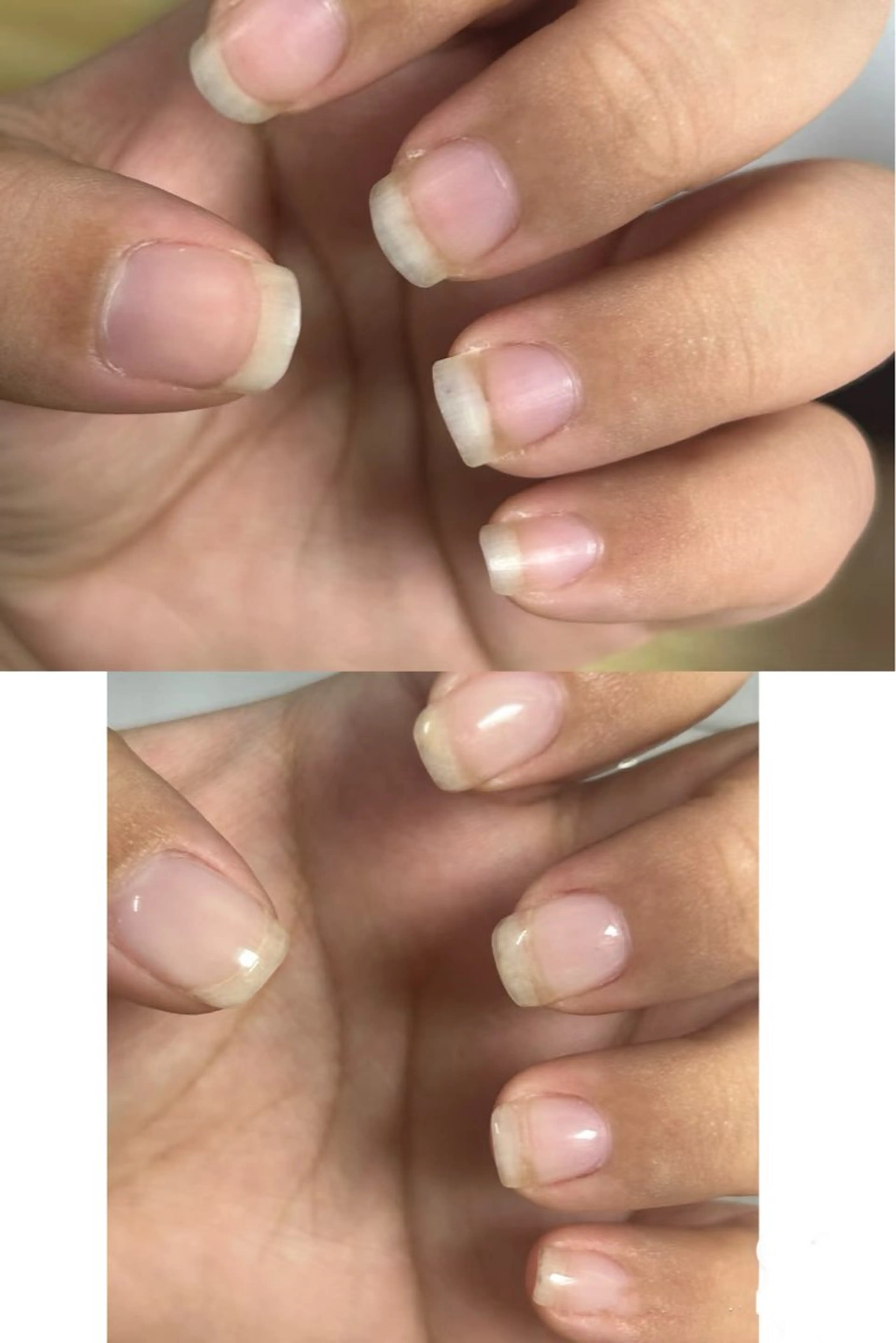 ジェルオフ+甘皮ケア【スカルプ+チップオフ3500円】の写真