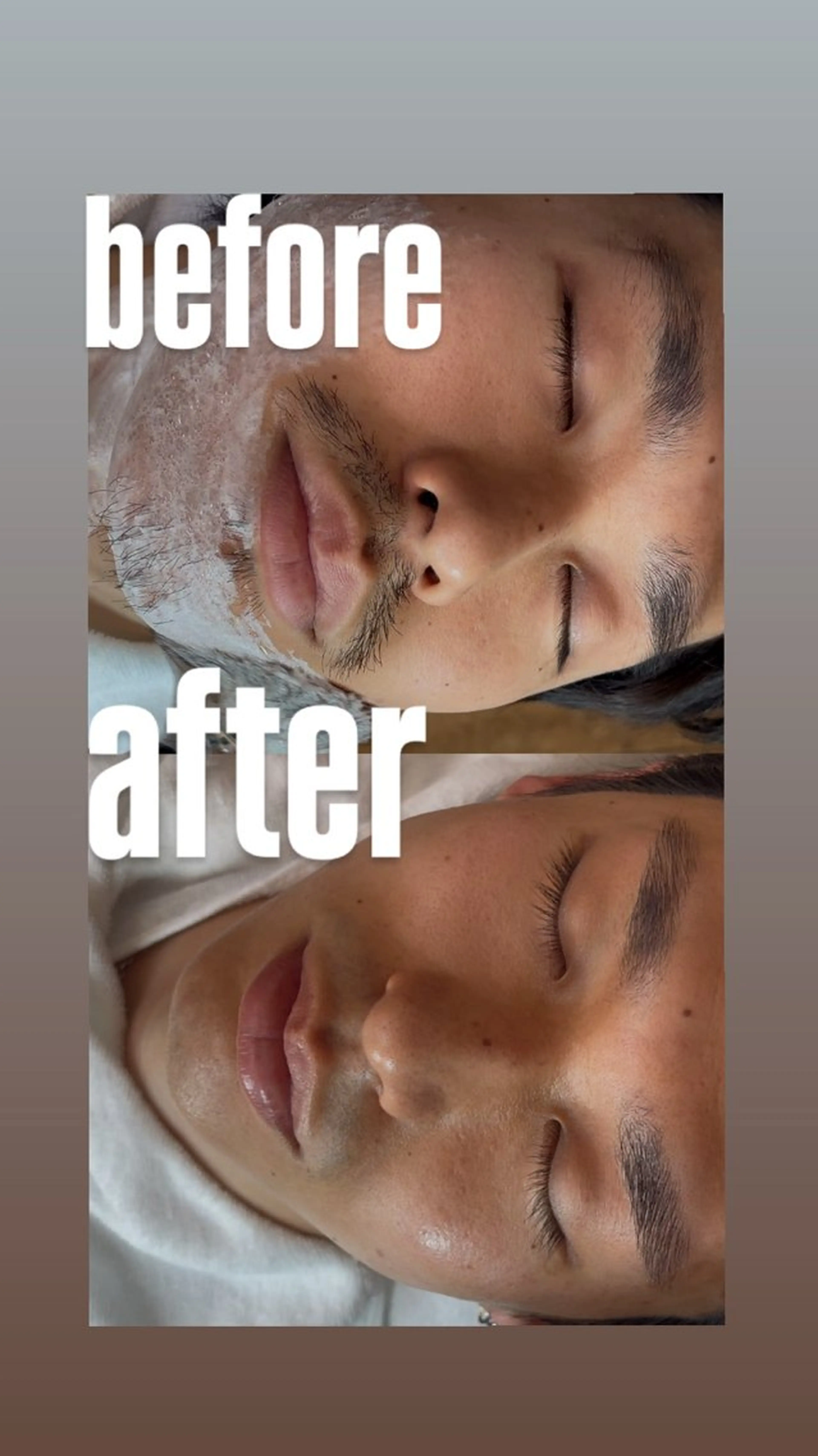 メンズ顔シェービングの写真