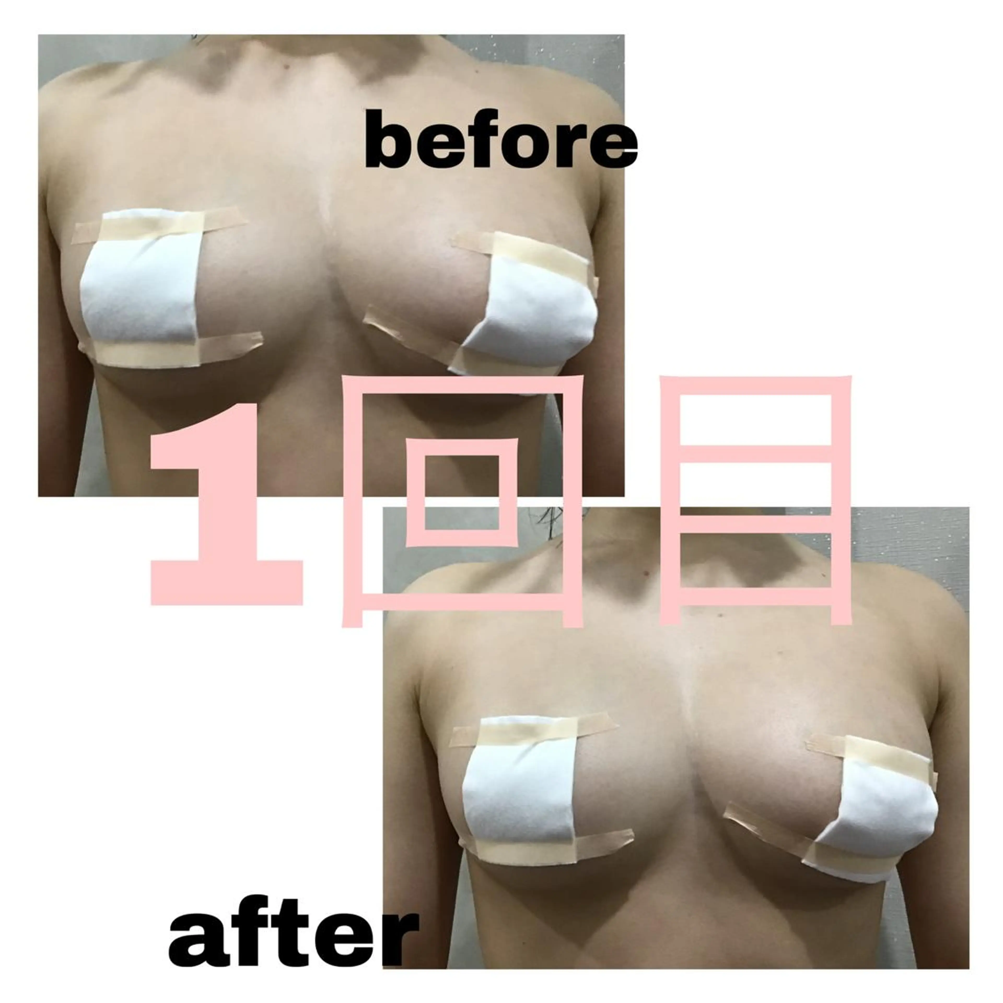 痩身/毛穴洗浄/脱毛 アルカンジュのエステ・リラクイメージ