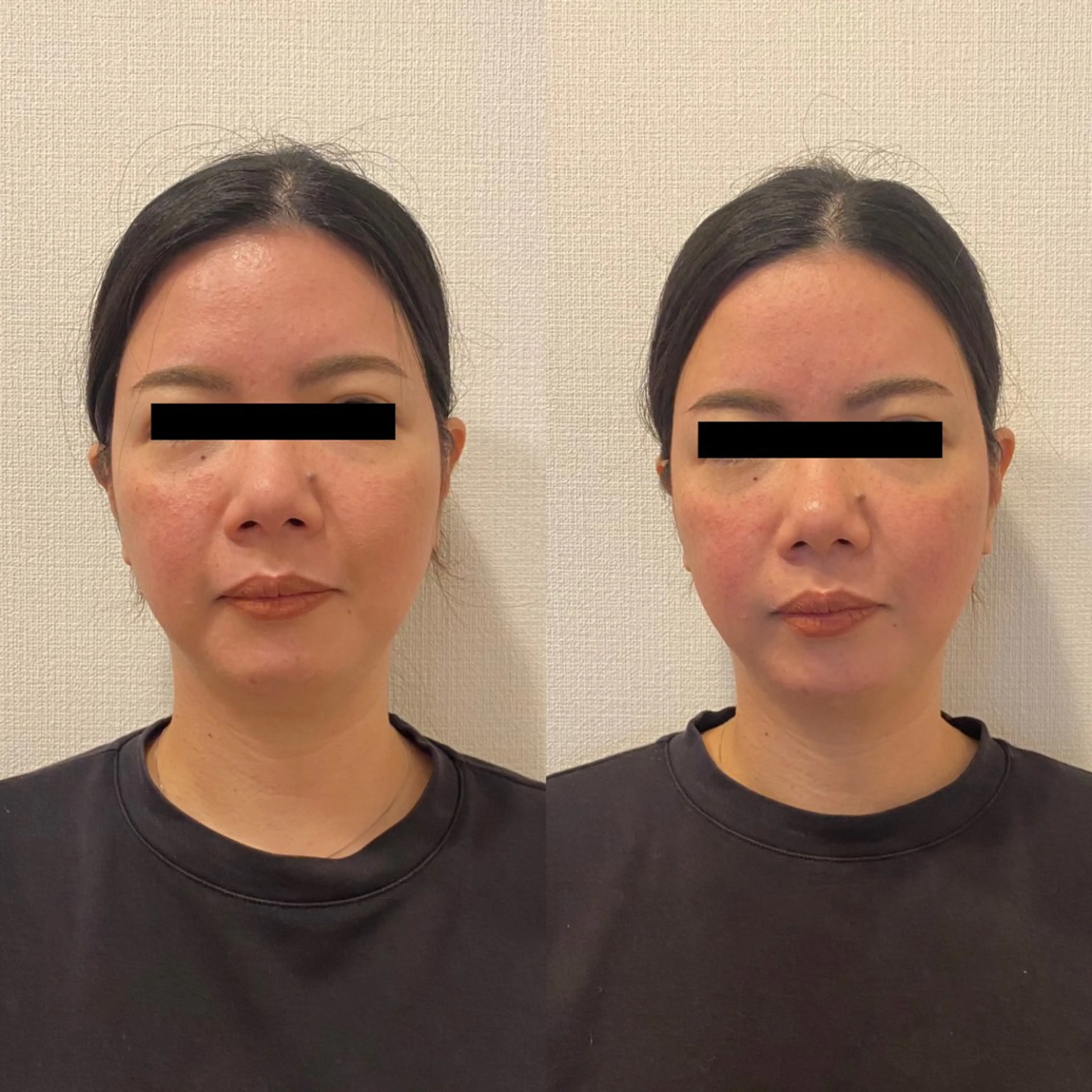 エステ＆リラク サロンMa-yaのエステ・リラクイメージ