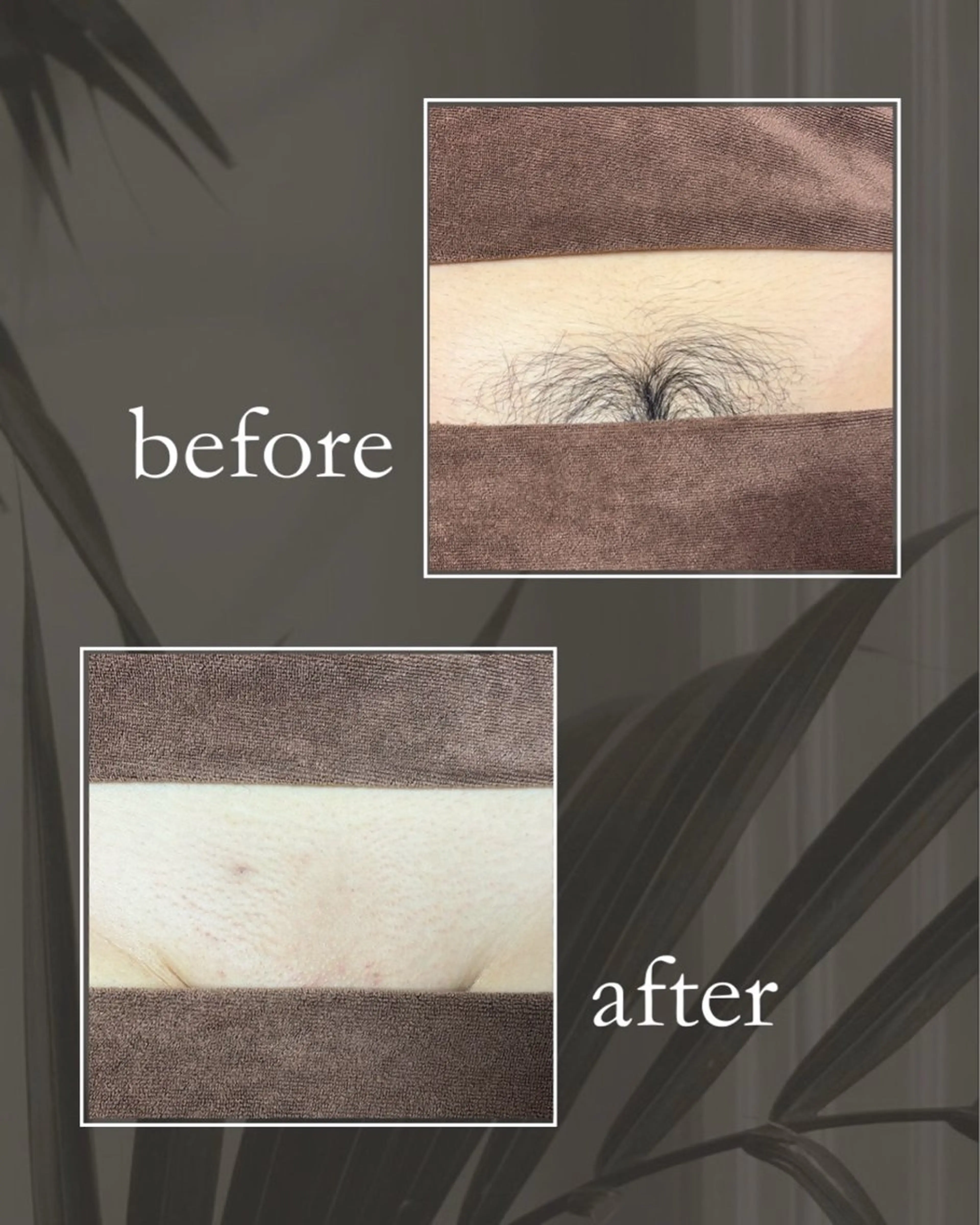 脱毛 砂原 慧子のエステ・リラクイメージ