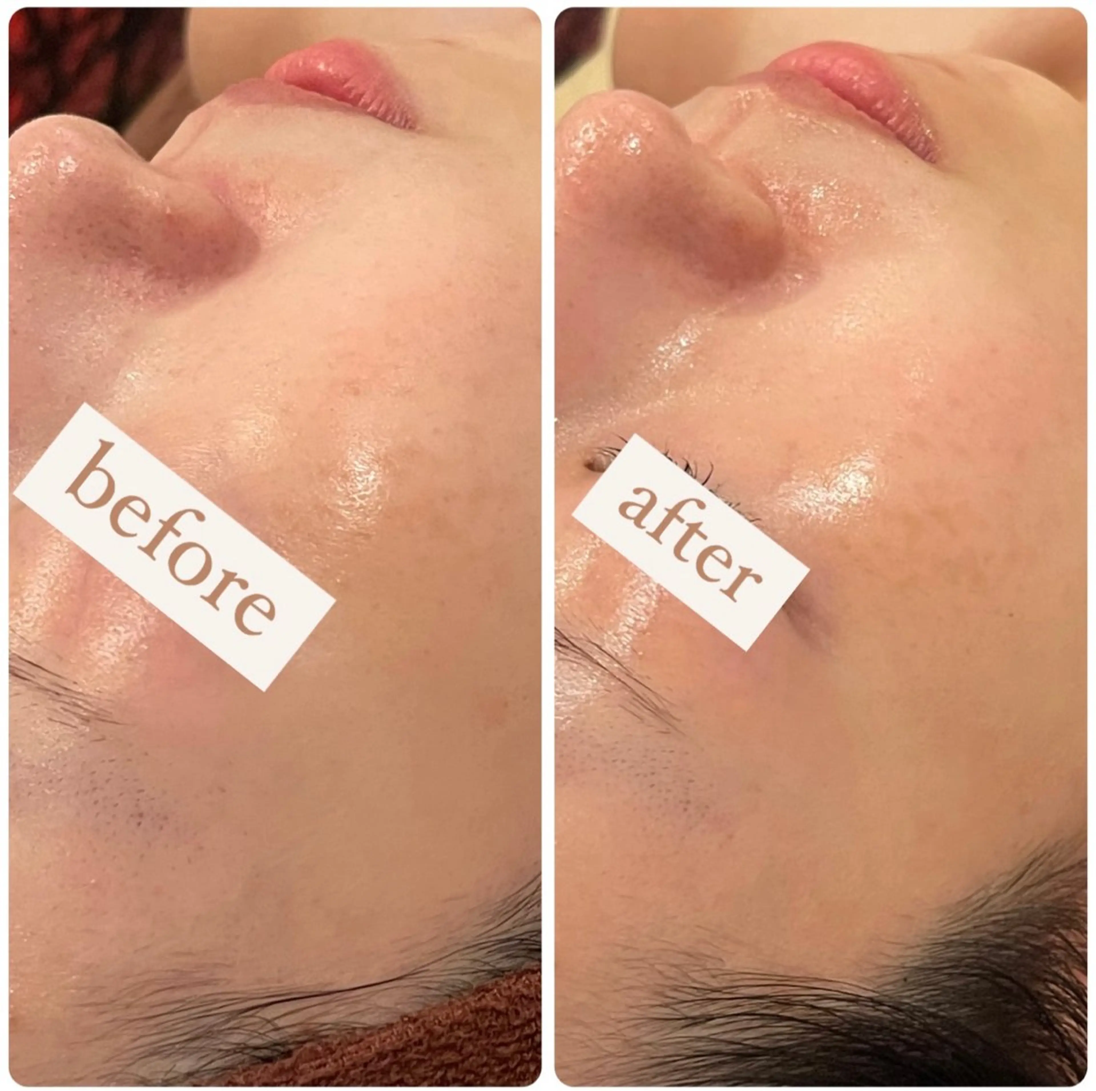 立体小顔×艶肌×美ボ ディ似合わせ施術 岡のエステ・リラクイメージ