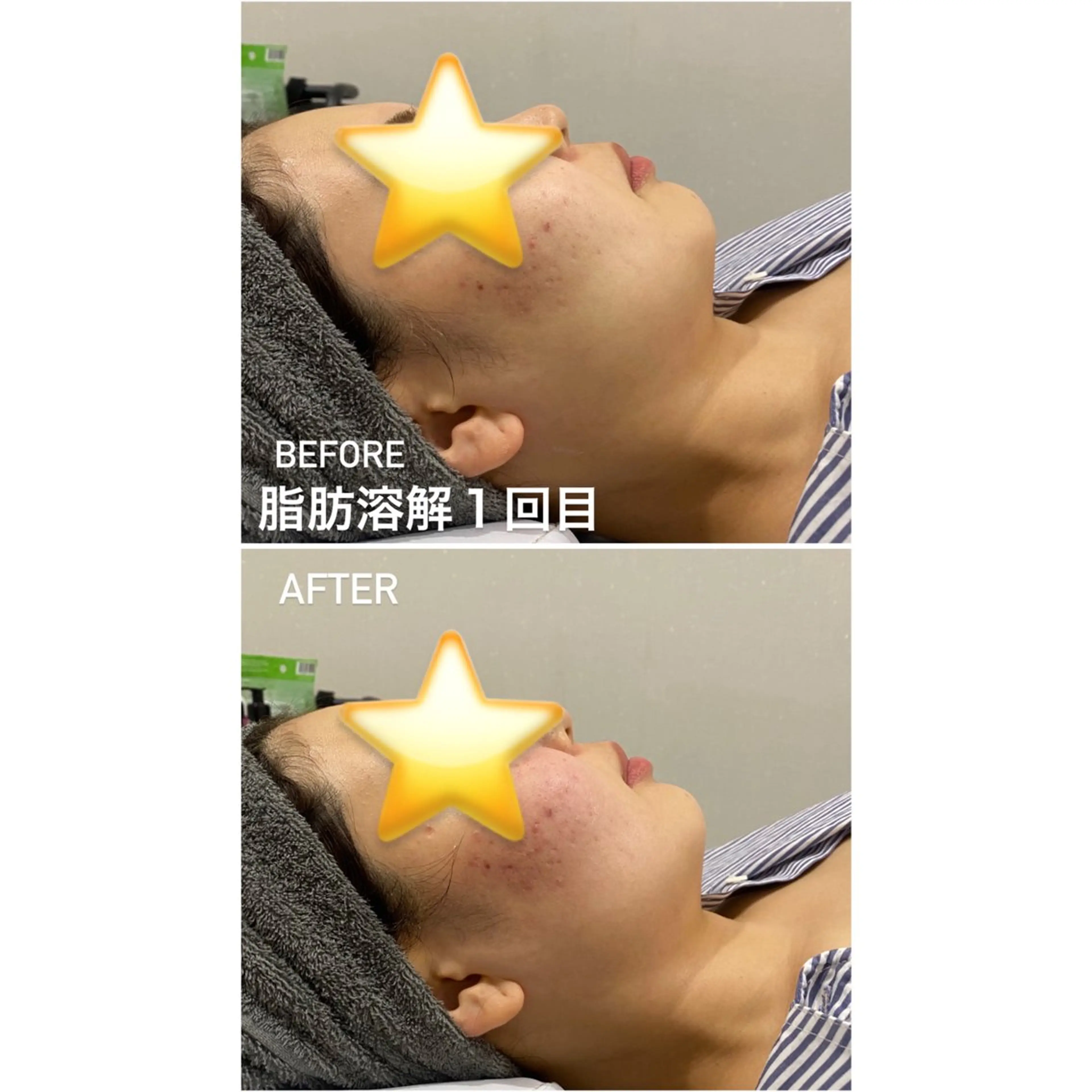 エステ 毛穴洗浄・痩身・脱毛 /アルカンジュのエステ・リラクイメージ