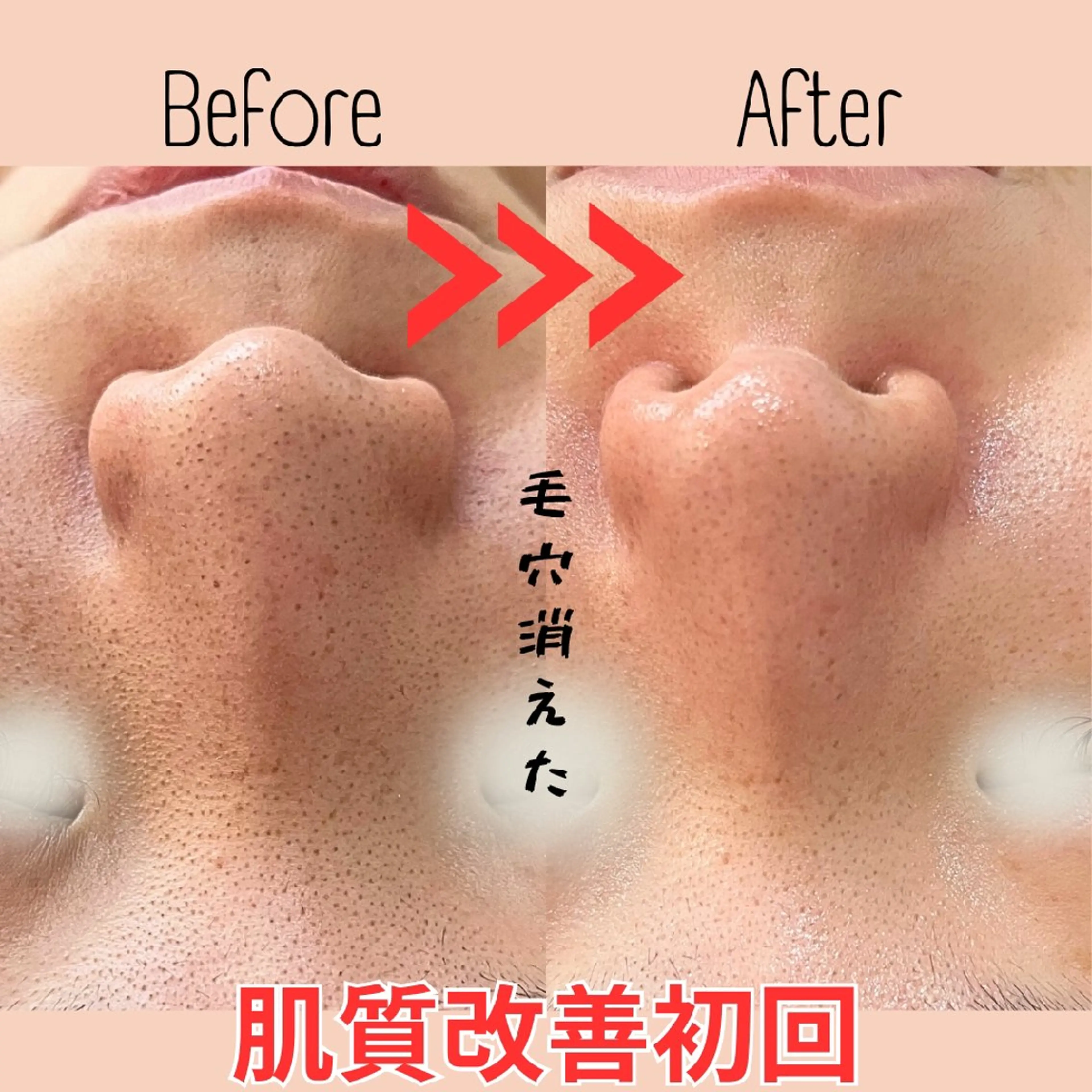 小顔コルギ&肌質改善 の専門店LIBREのエステ・リラクイメージ