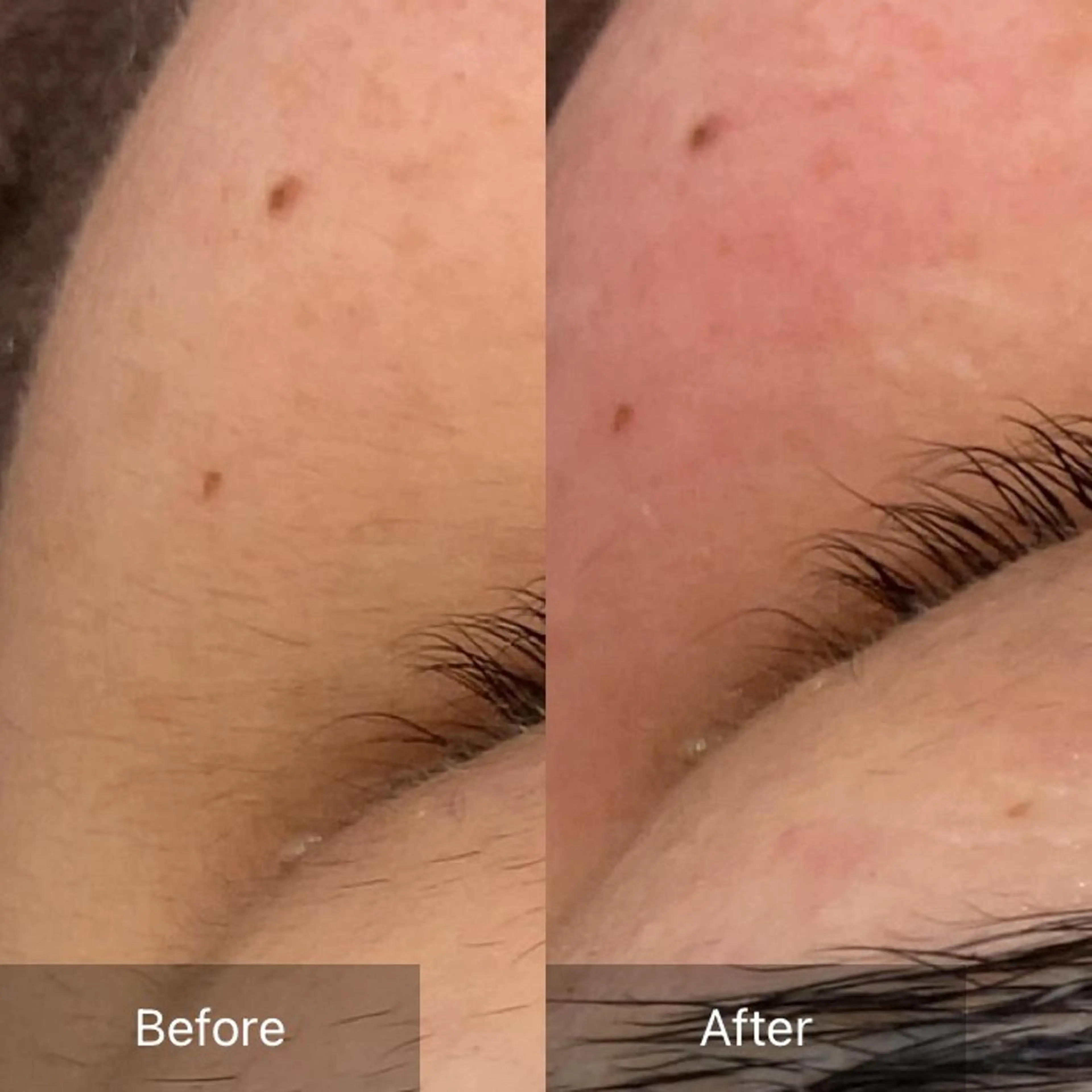 脱毛 産毛専門店 Bittoのエステ・リラクイメージ