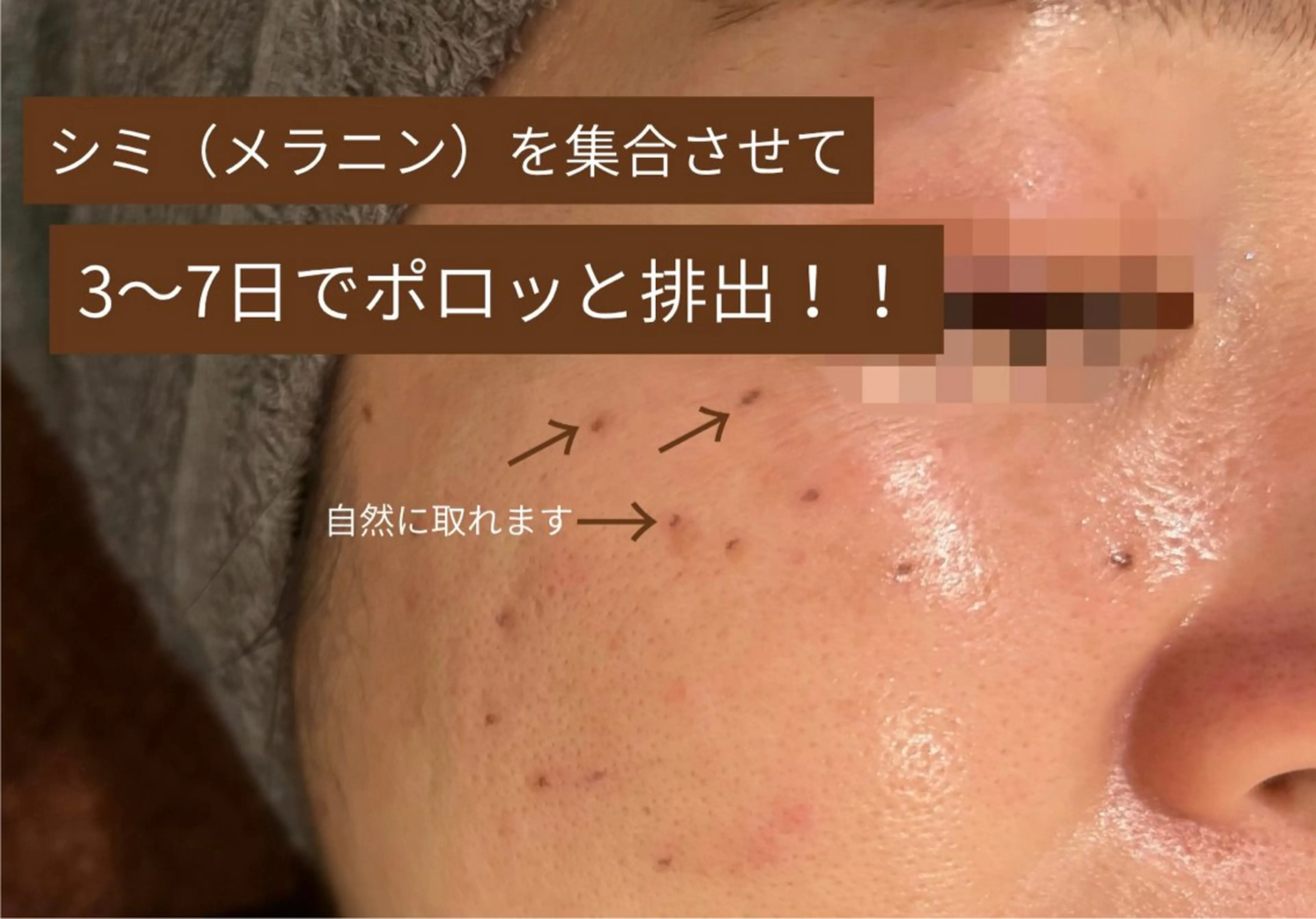 エステ ラシュシュ 茨木のエステ・リラクイメージ