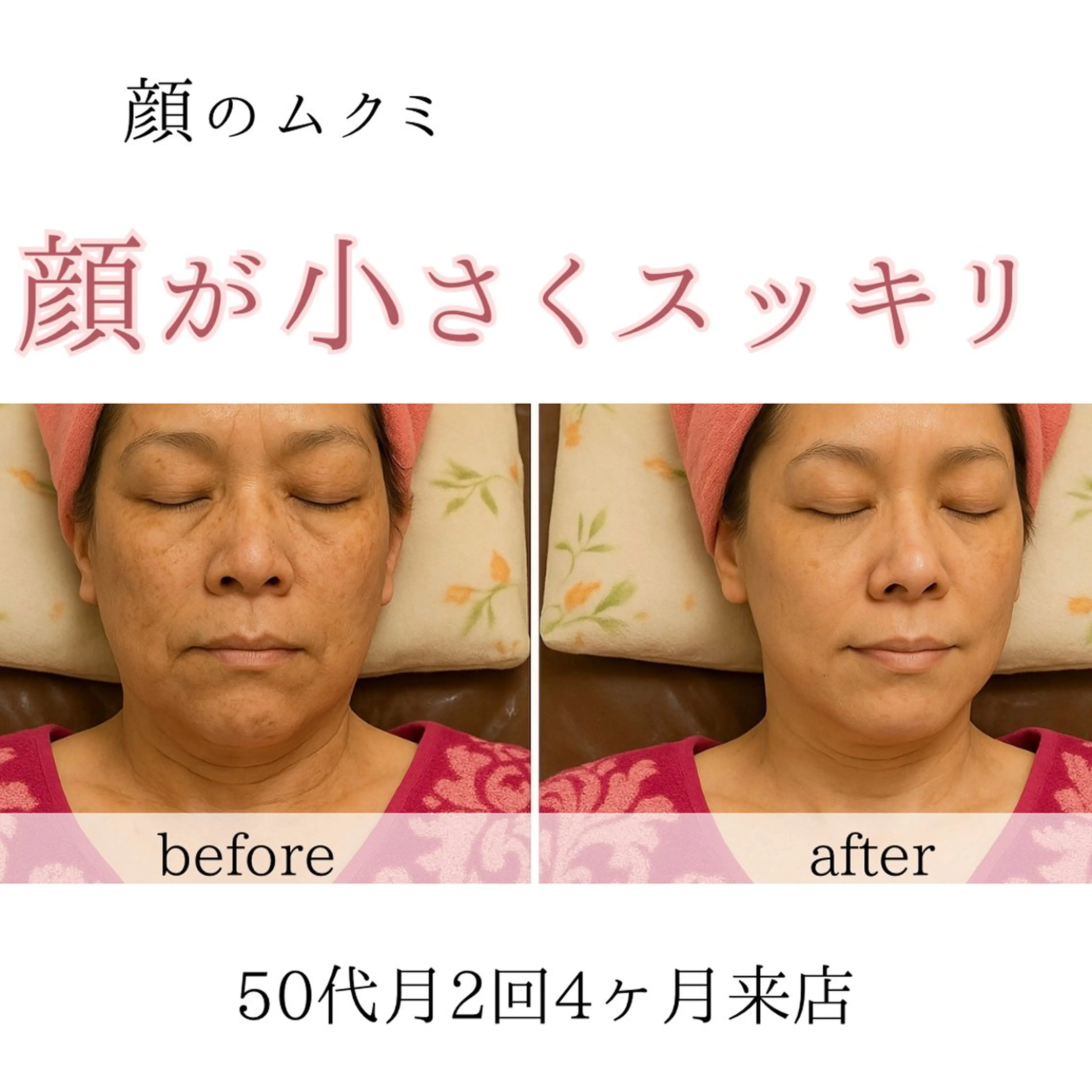 小顔・ニキビ ・脱毛サロンのエステ・リラクイメージ