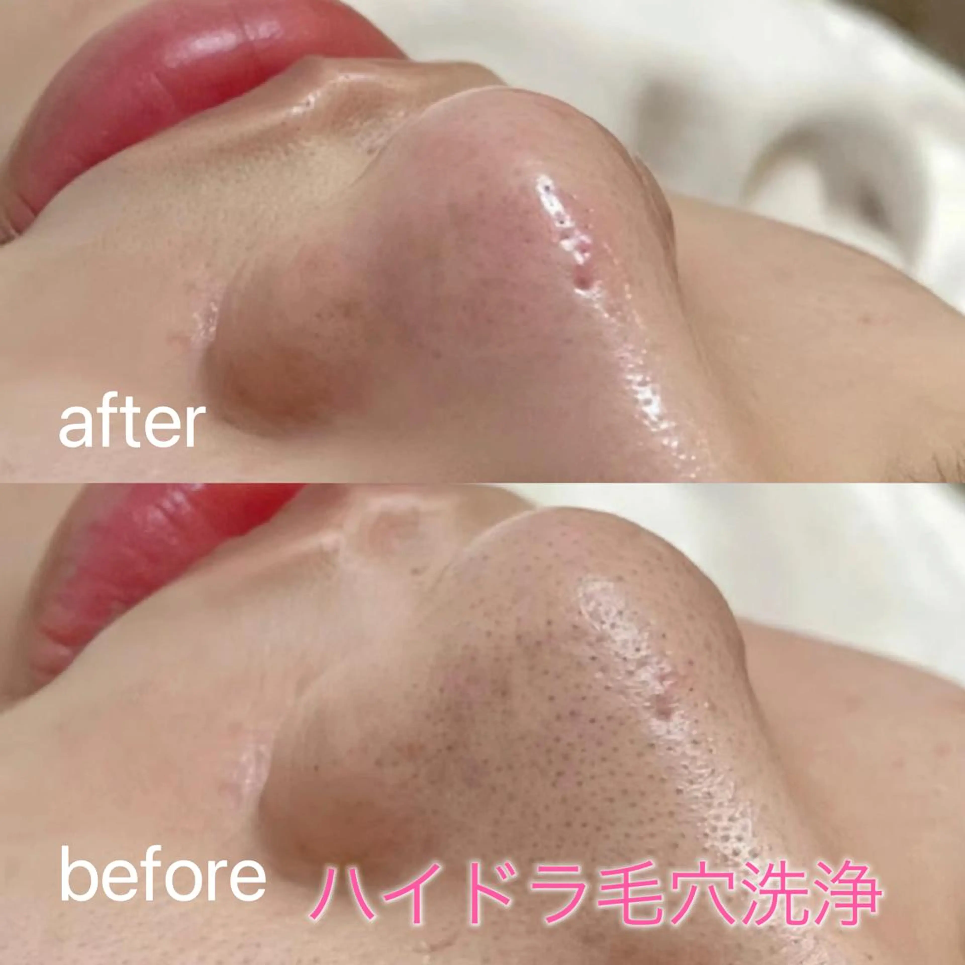 エステ リラク 毛穴洗浄& 睫毛パーマ上野御徒町のマツエク・マツパデザイン