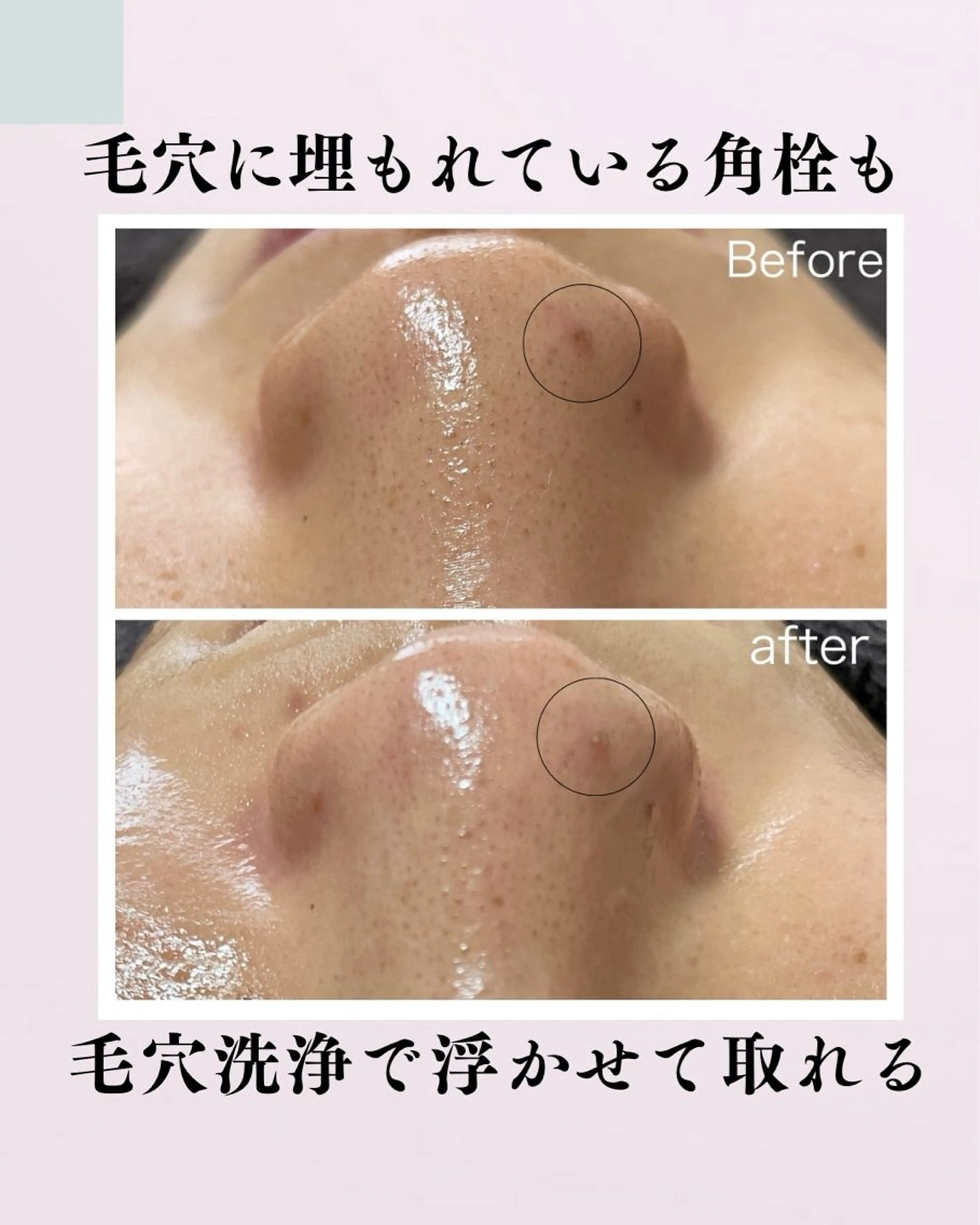 肌質改善サロン facialmoonのエステ・リラクイメージ