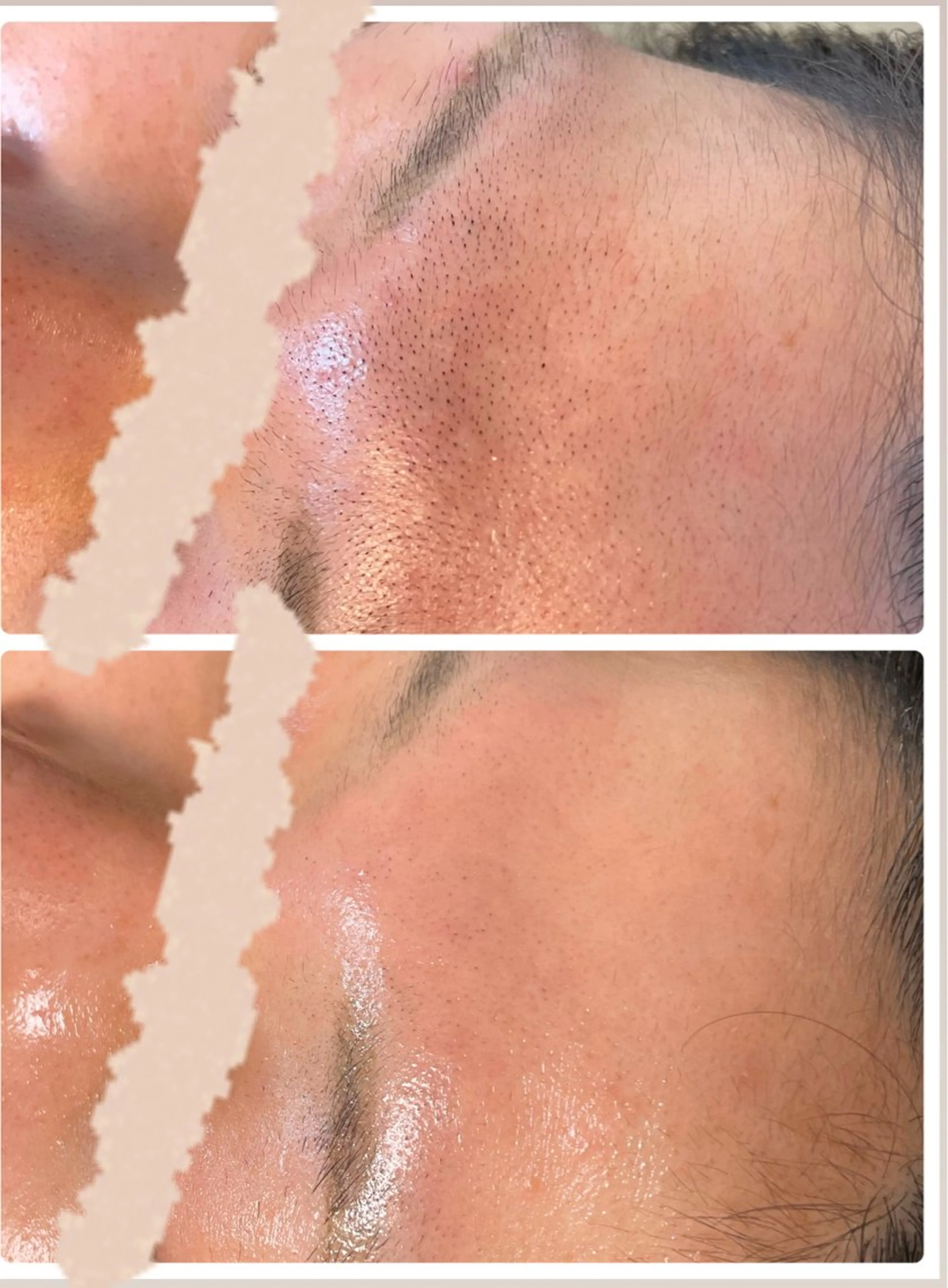 アイブロウ 代表 MOMOのエステ・リラクイメージ