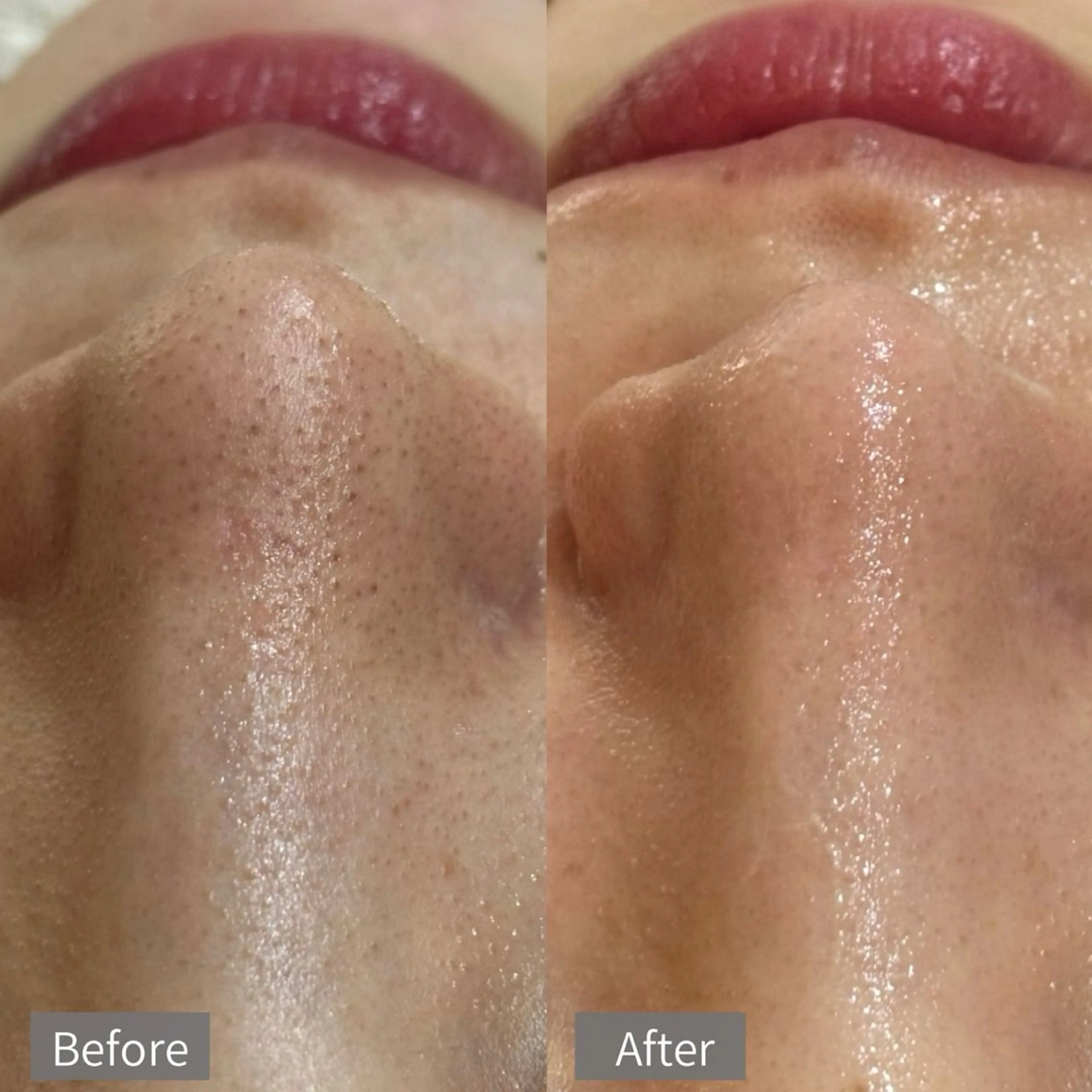 Suu.千種/今池 毛穴洗浄/韓国肌管理の眉毛・アイブロウイメージ