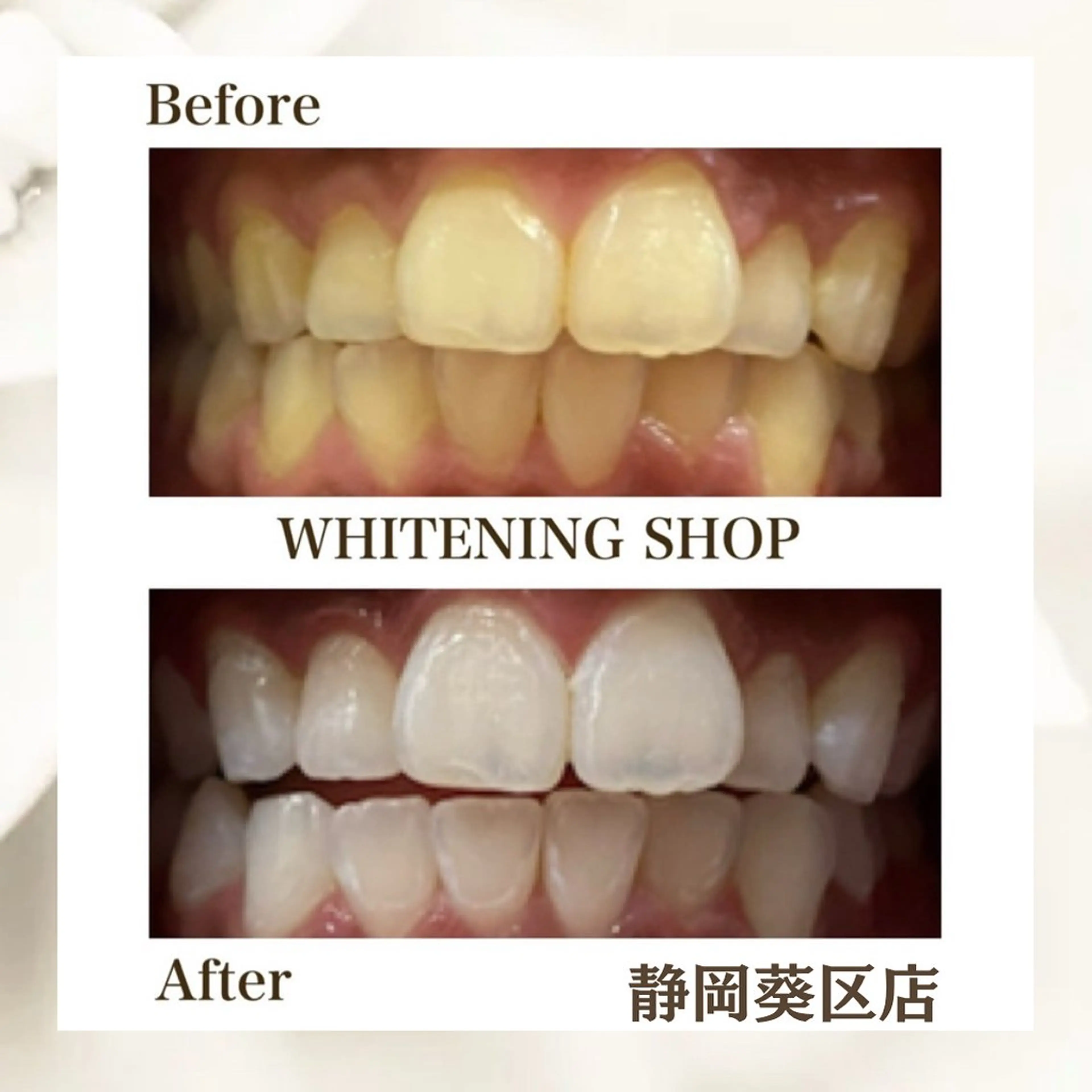 ホワイトニング ショップ葵区静岡駅店のその他イメージ