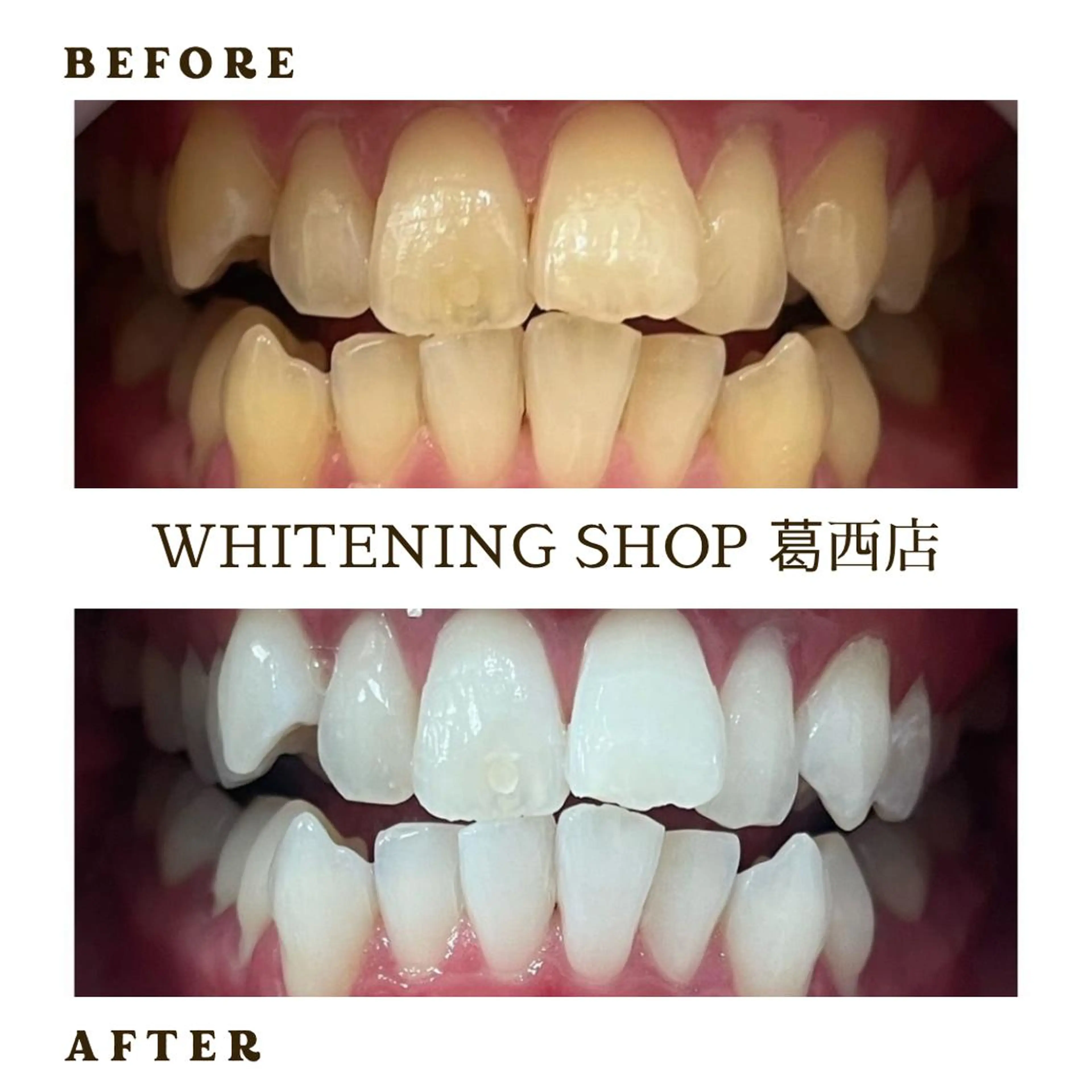 キッズ メンズ ホワイトニング ショップ葛西店のその他イメージ