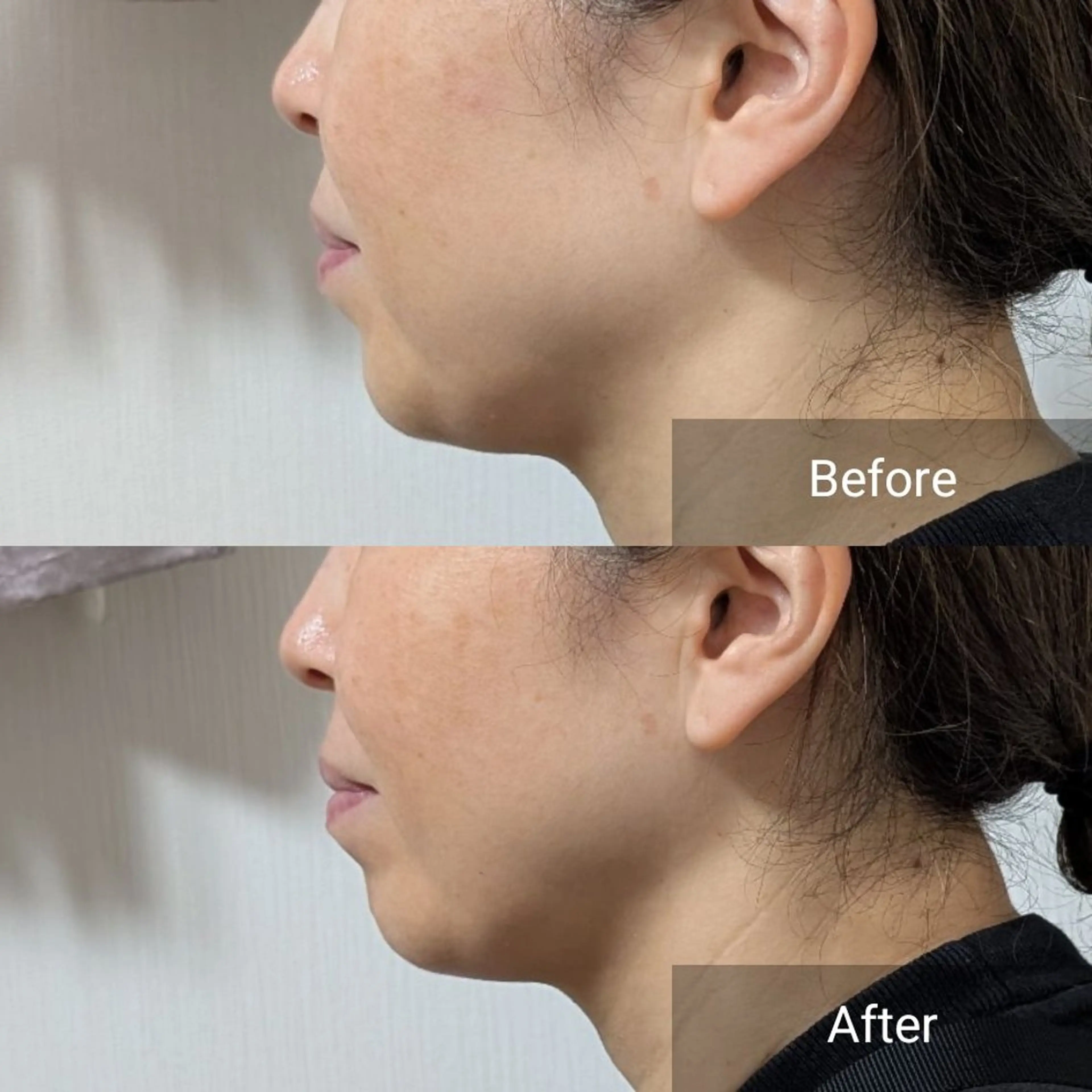 エステ nail RiRi アトレナチュラのエステ・リラクイメージ