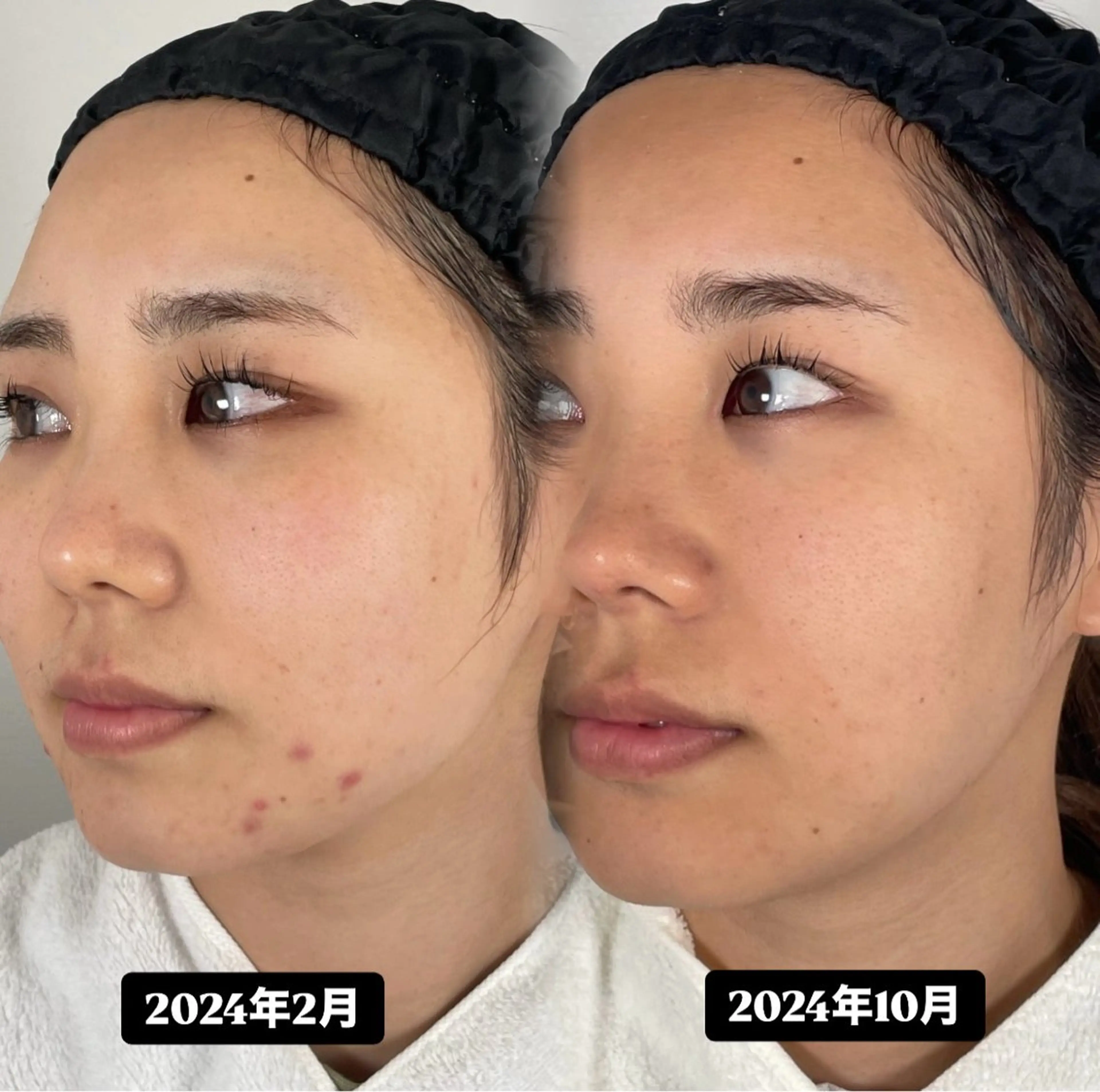 🫧美しい素肌へ🫧 今成柚乃のその他イメージ