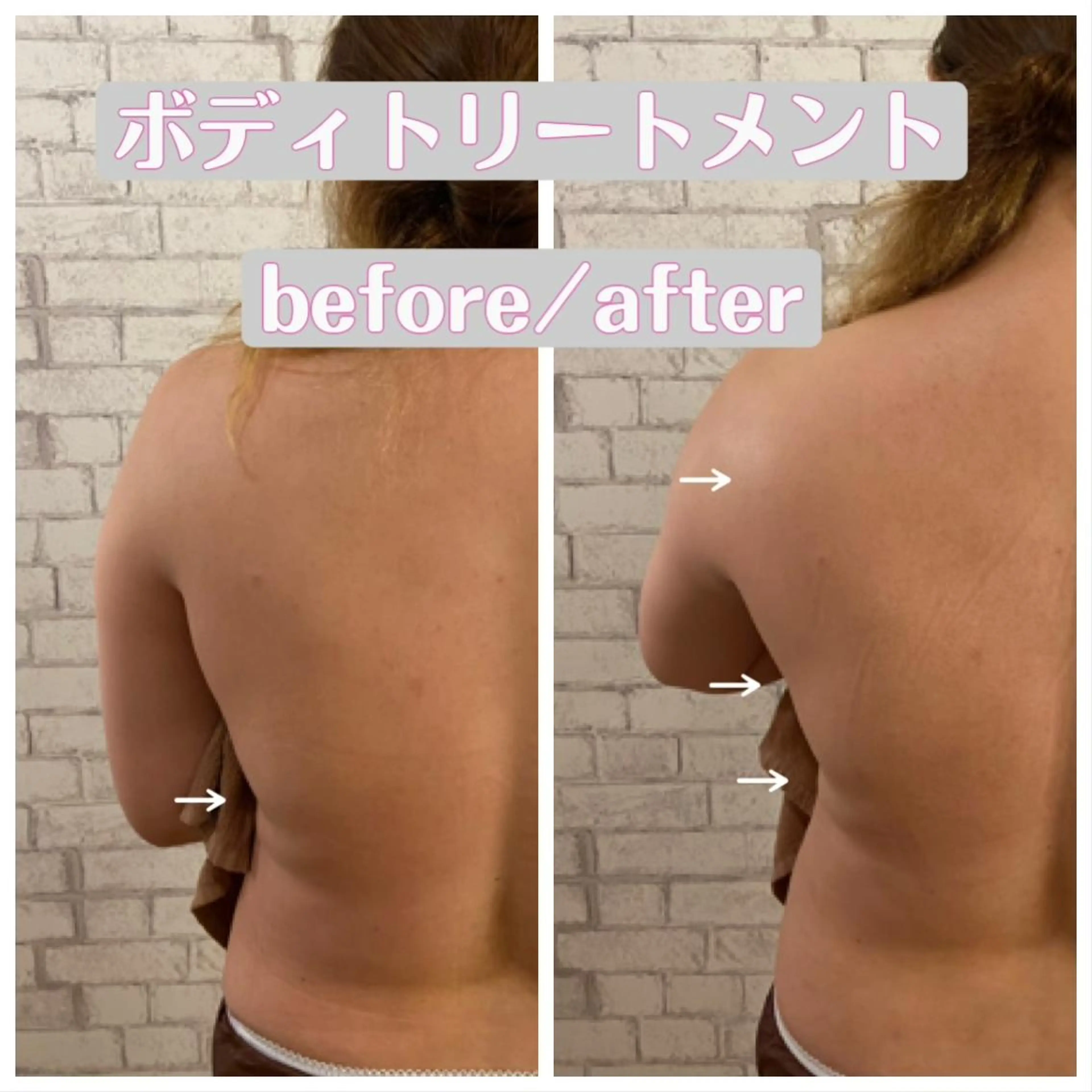 【小顔矯正】 salonaceのエステ・リラクイメージ